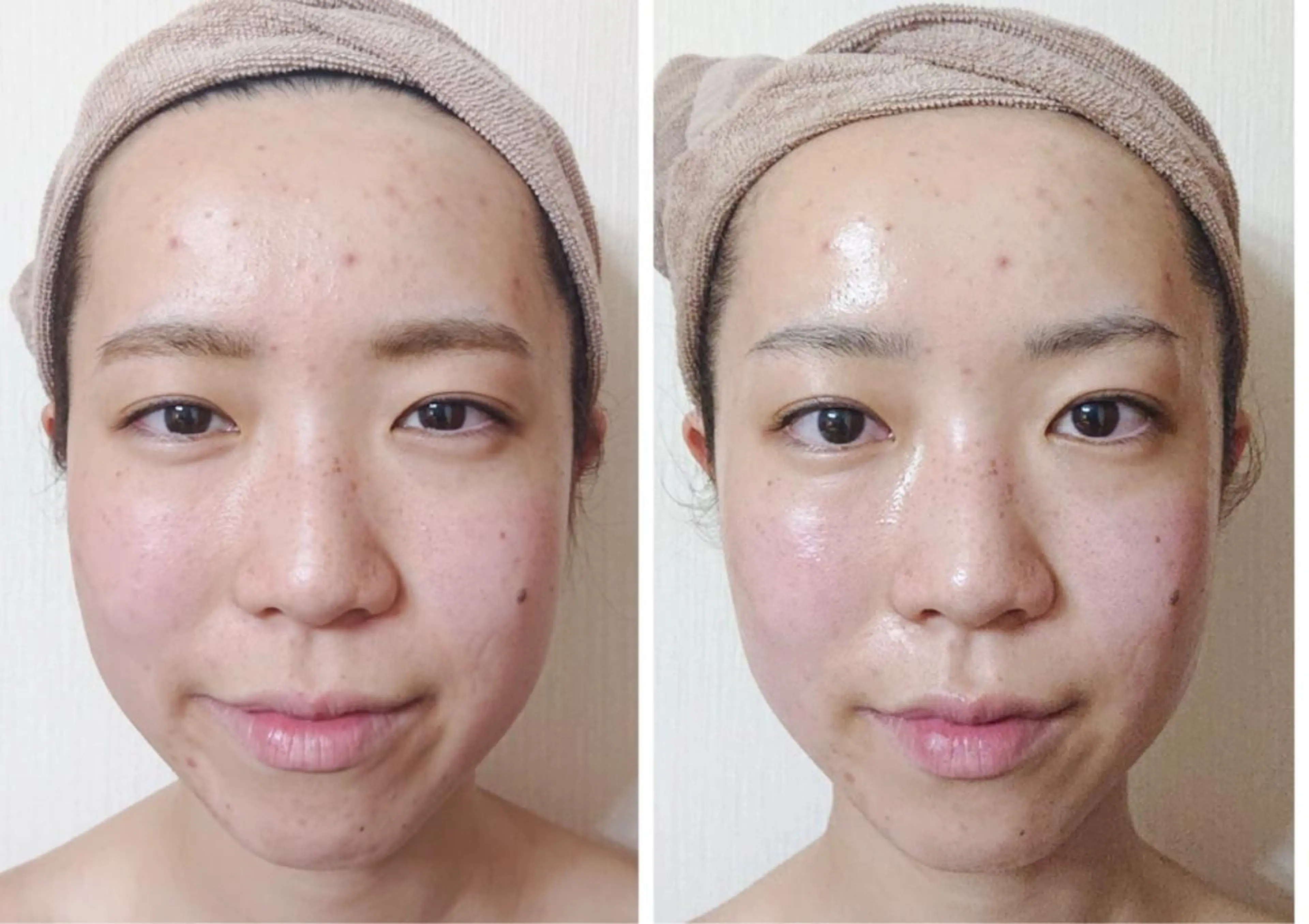 杉井 美恵のエステ・リラクイメージ