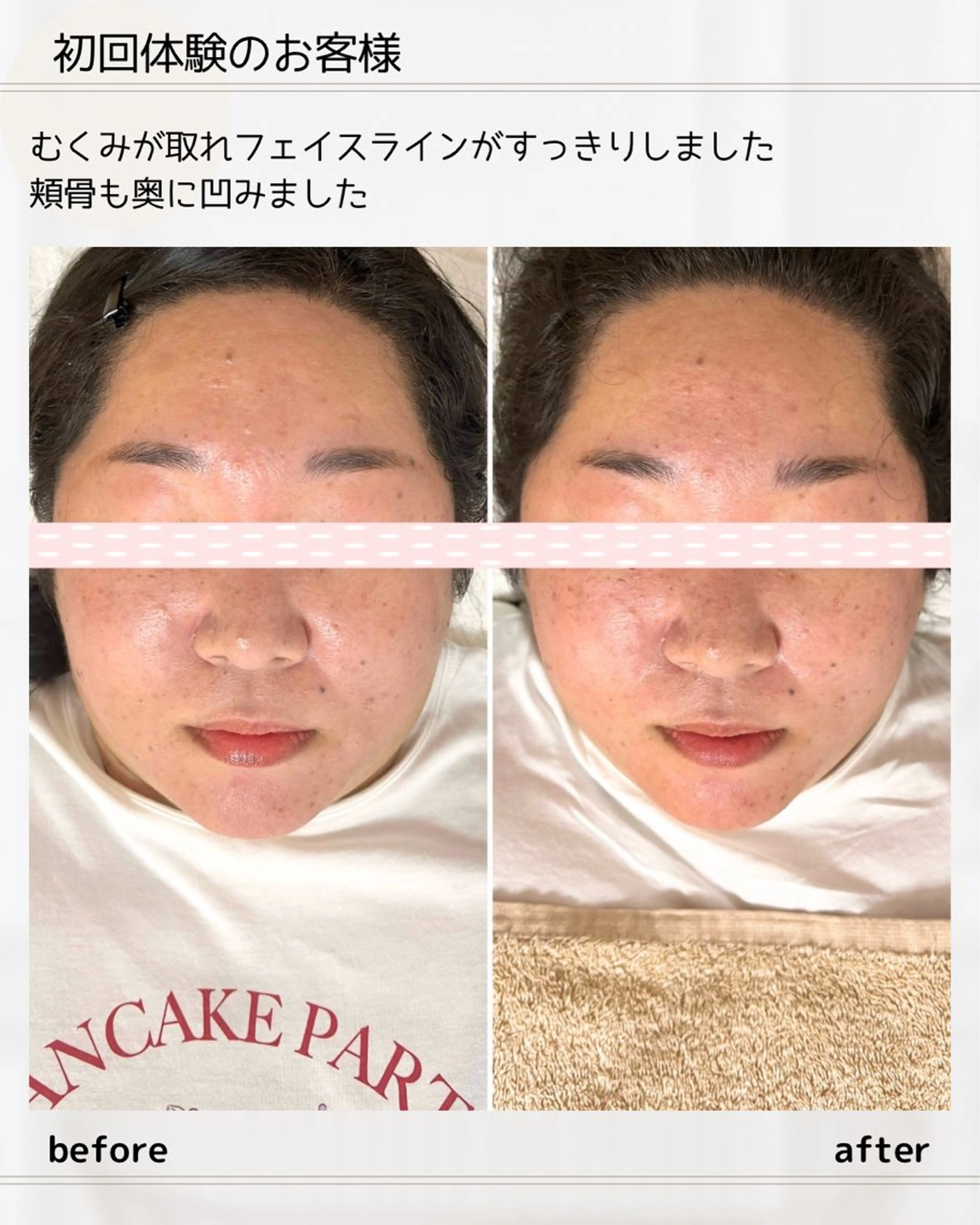 【超ロング‼️効果重視】180分 お顔&全身の慢性的なこり•歪み改善!ロング好きな方は絶対コレ!かなりお得🎉🉐の写真