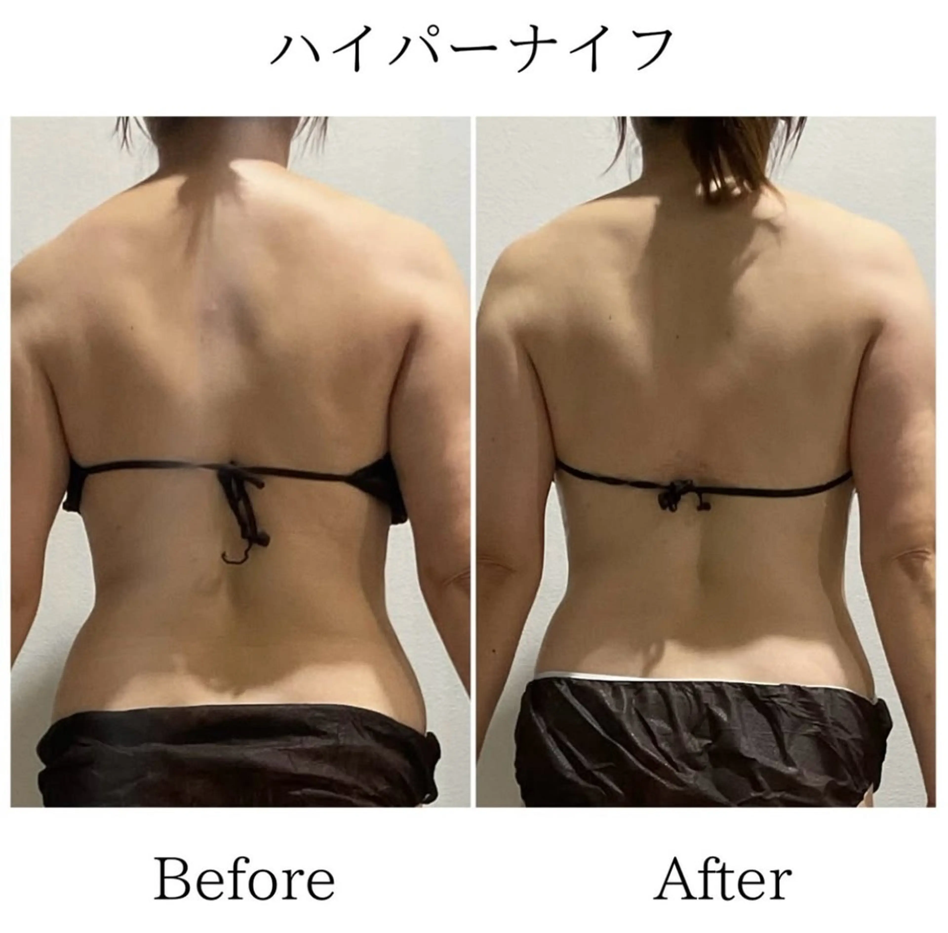 エステ LiLL 熊本のエステ・リラクイメージ