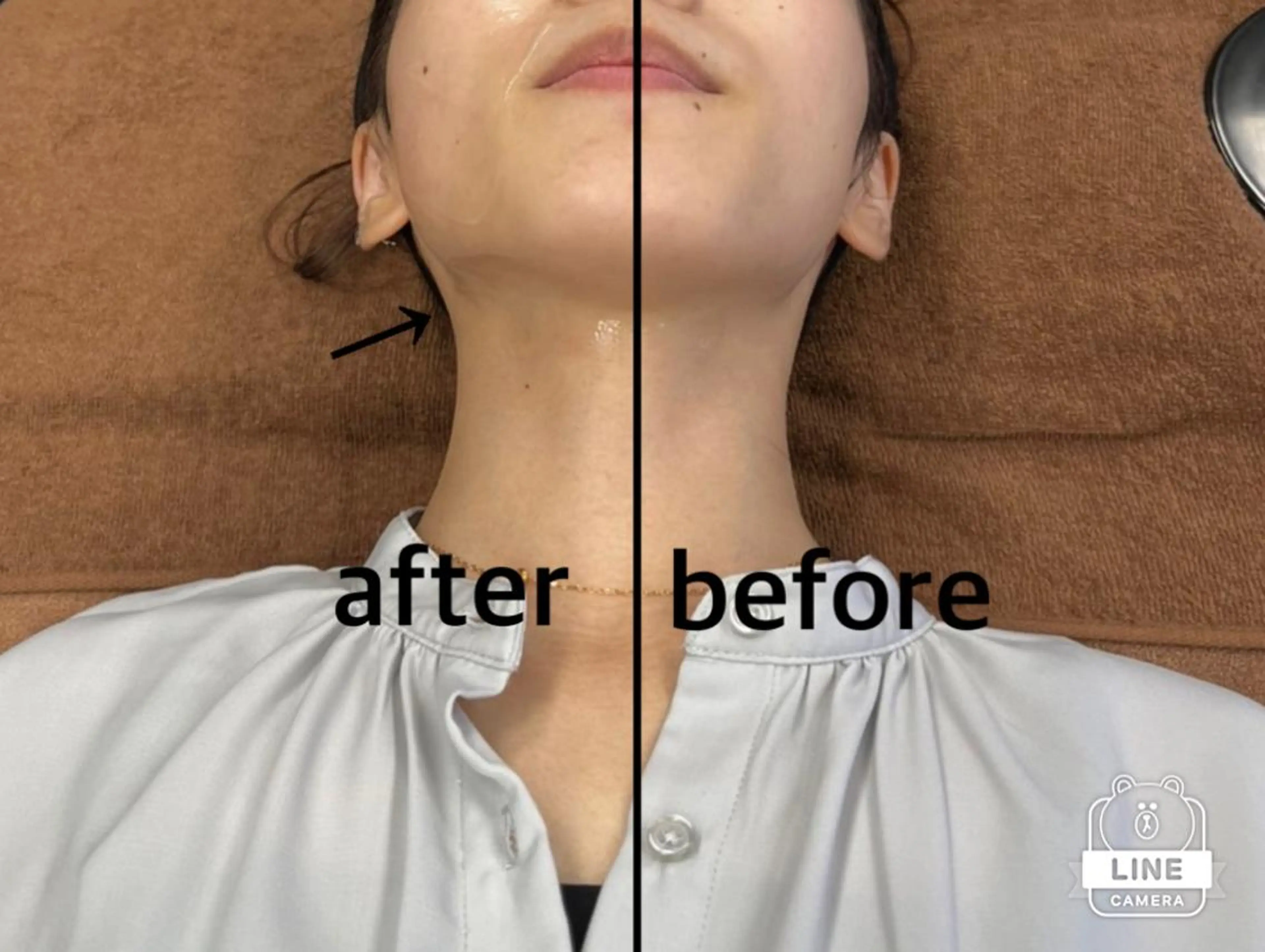 エステ 脱毛/痩身/頭皮ケア GLYCINEのエステ・リラクイメージ