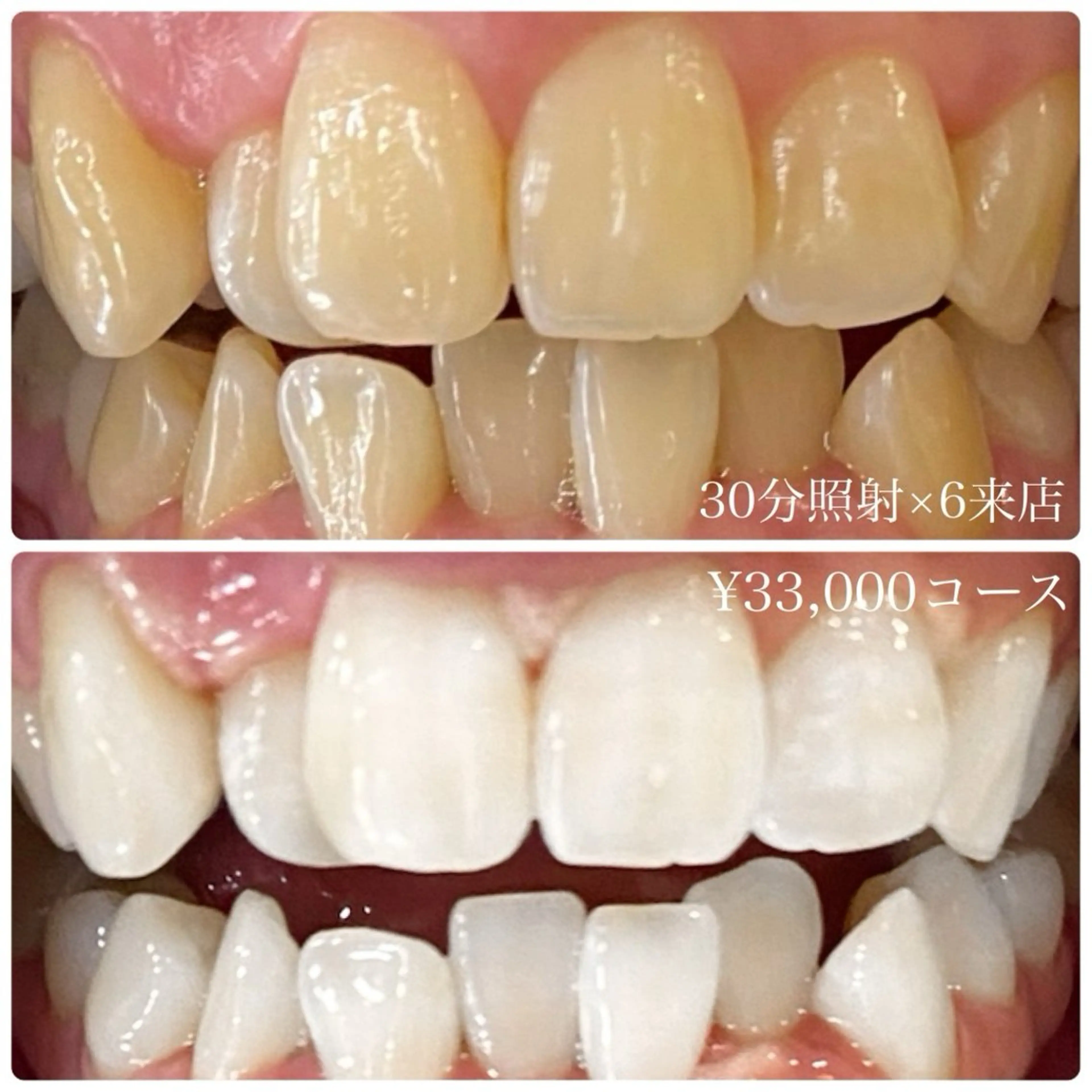 その他 ホワイトニングルーム 横浜店のその他イメージ