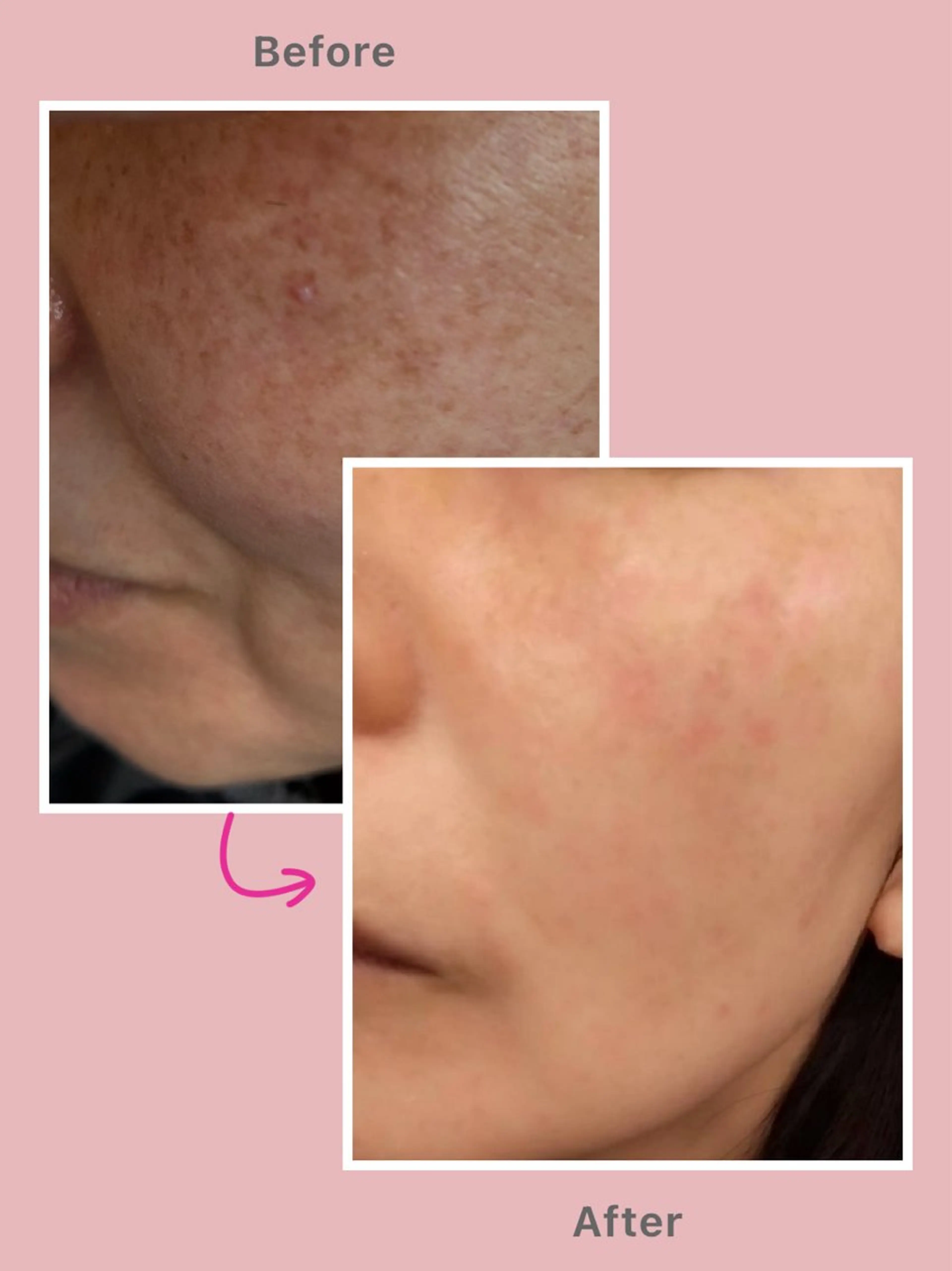 ELEGANCE所属・メンズ脱毛サロン BRIGHTのエステ・リラクイメージ