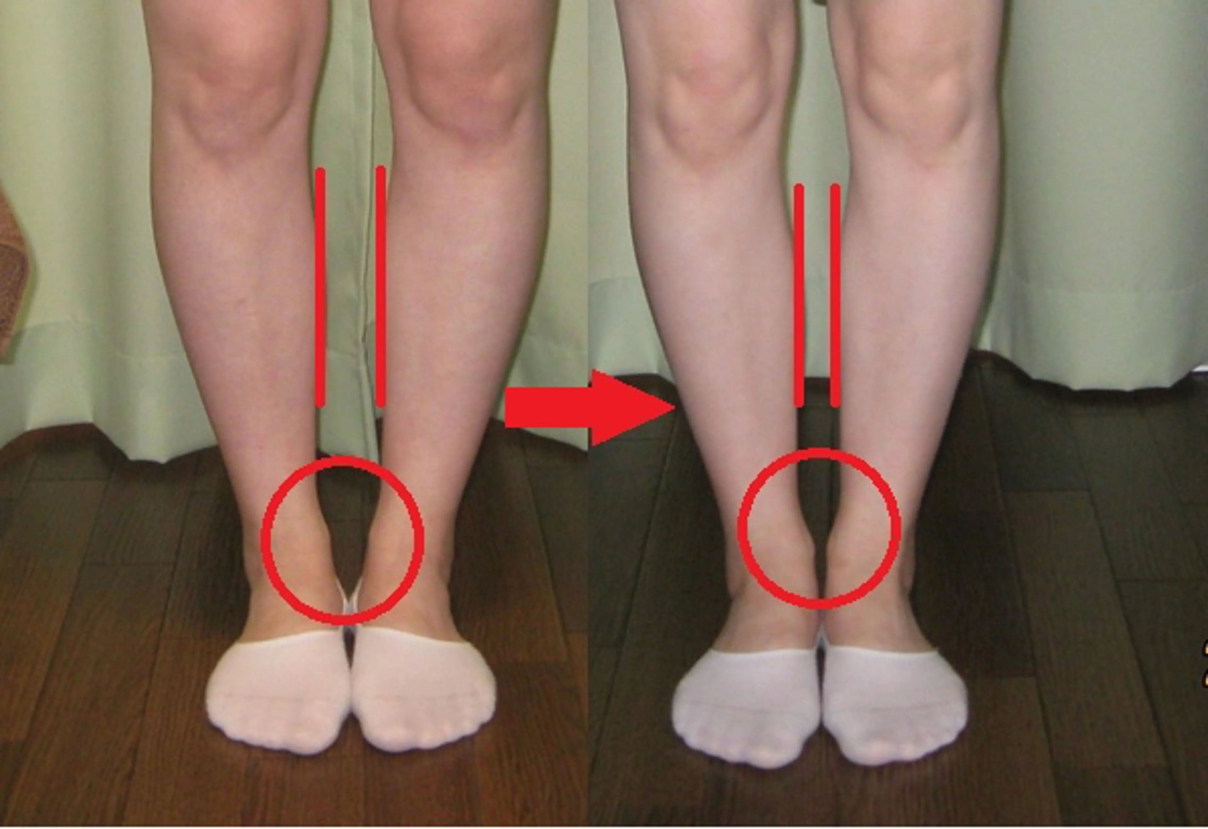 ゆがみ専門整体♪骨盤 姿勢 美脚✨清水貞利のエステ・リラクイメージ