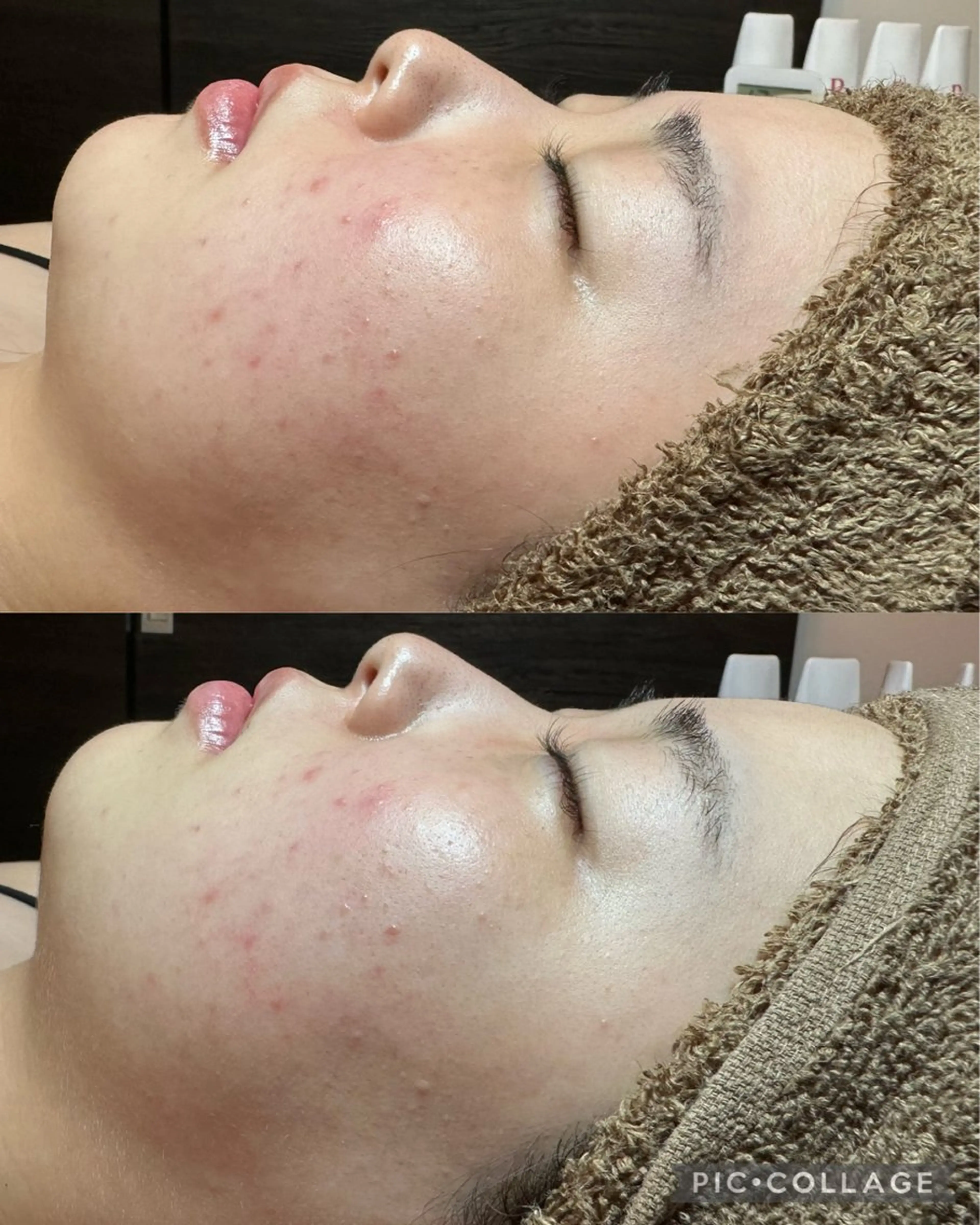 エステ Feel♡ JYURIAのネイルデザイン