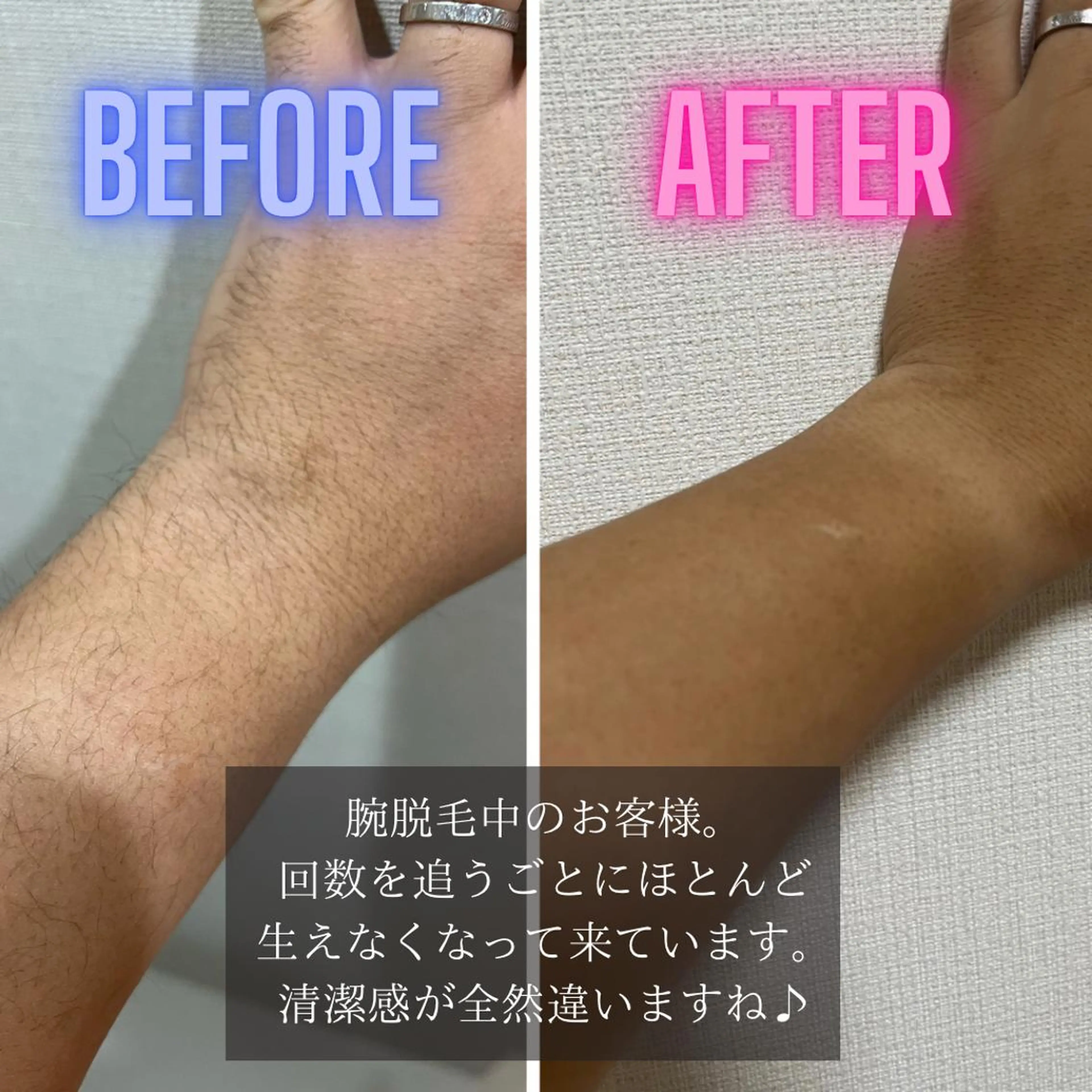 メンズ 脱毛 FOX 心斎橋店のエステ・リラクイメージ