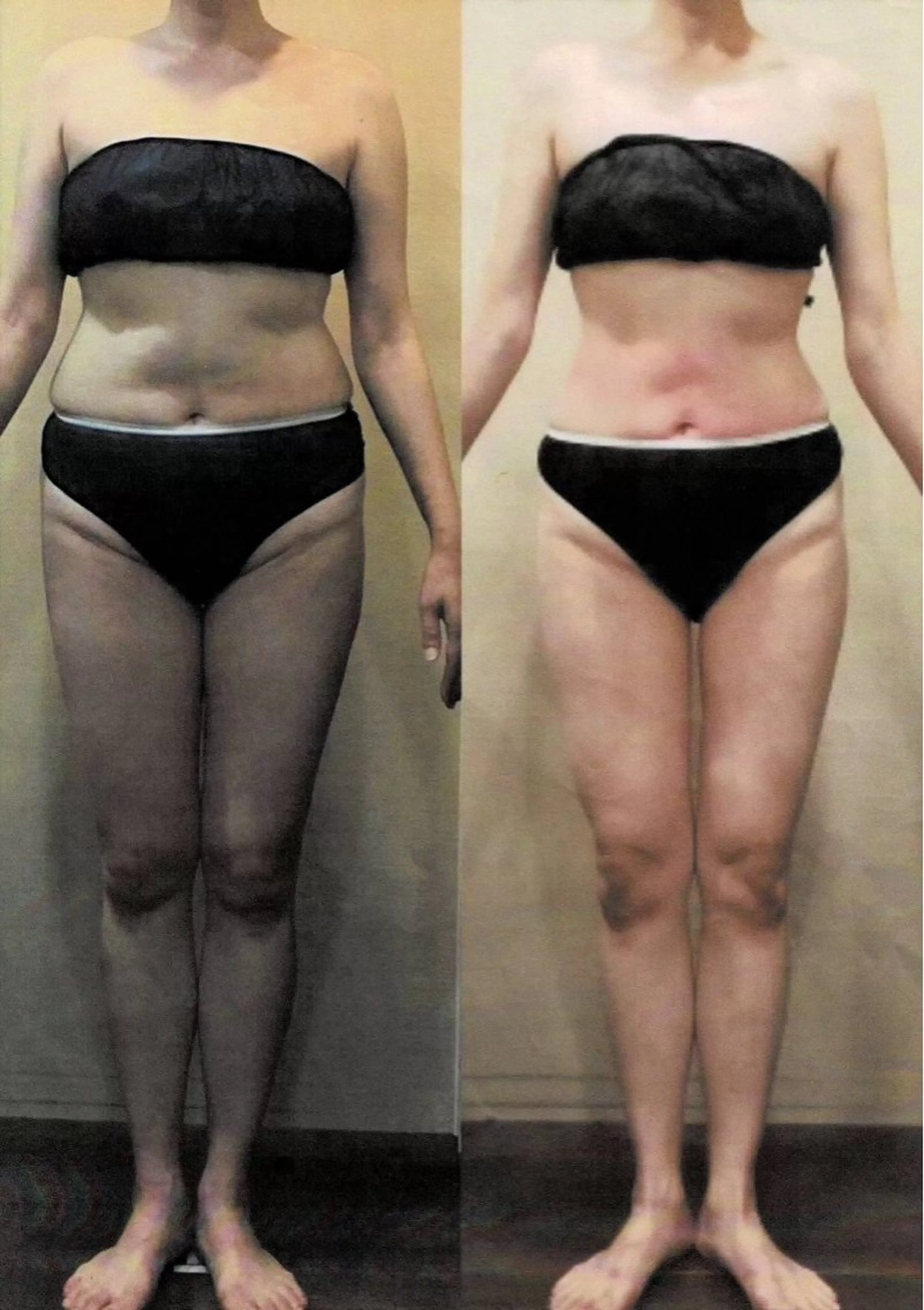 トータルビューティー リアラココ　上田仁美のその他イメージ