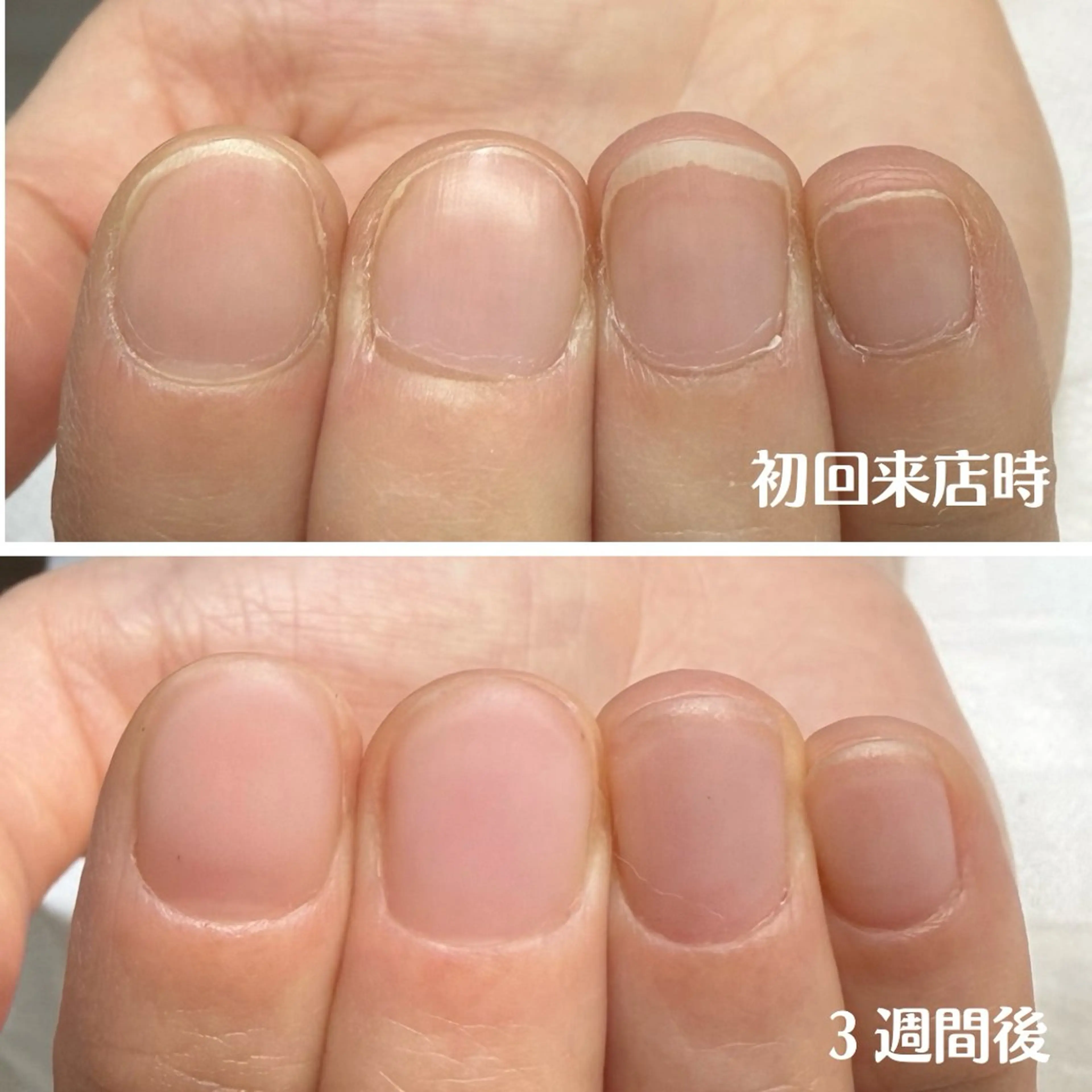 自爪育成ネイルケア&クリアジェルネイル(2回分)の写真