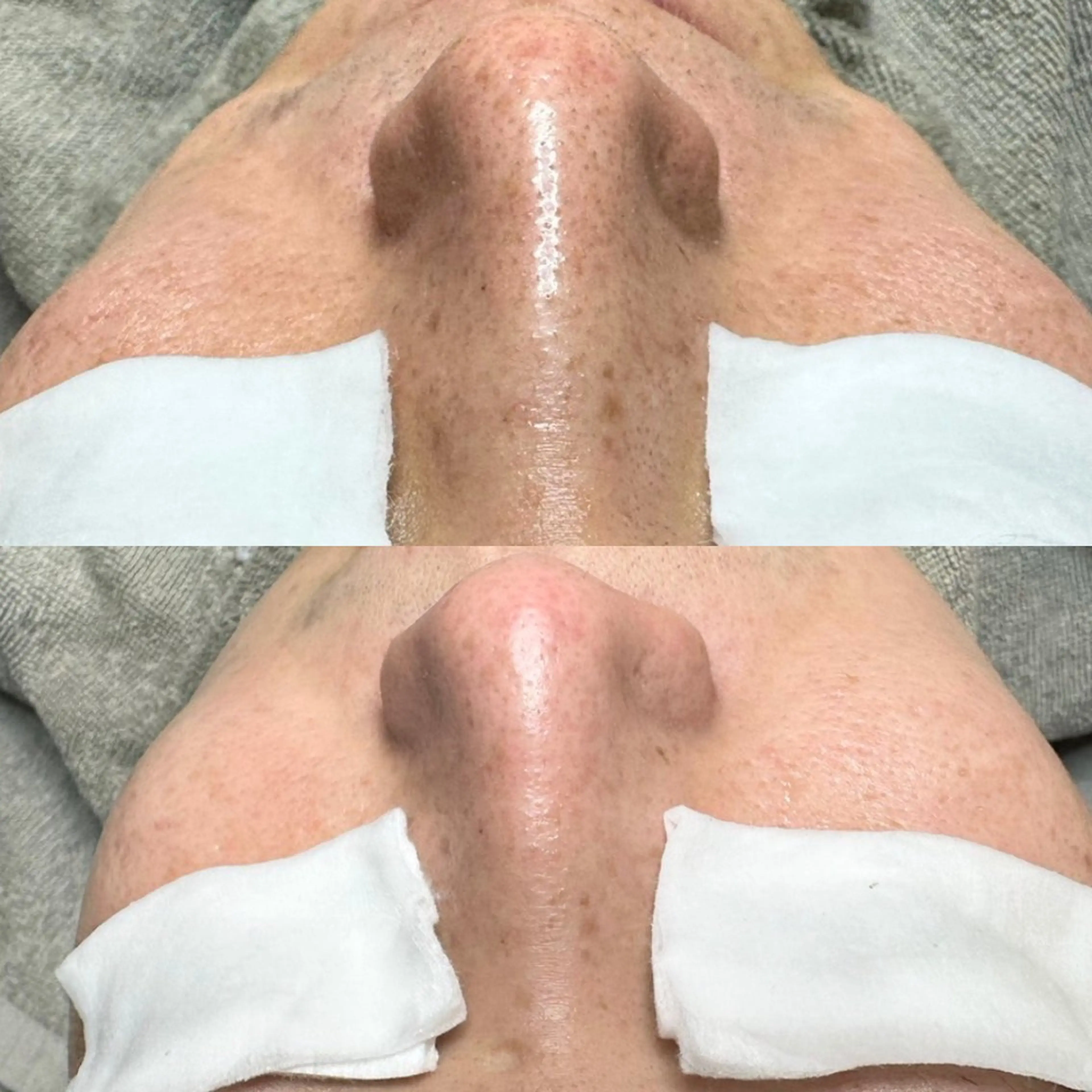 エステ 毛穴ケア特化専門店 トネア自由が丘店のエステ・リラクイメージ