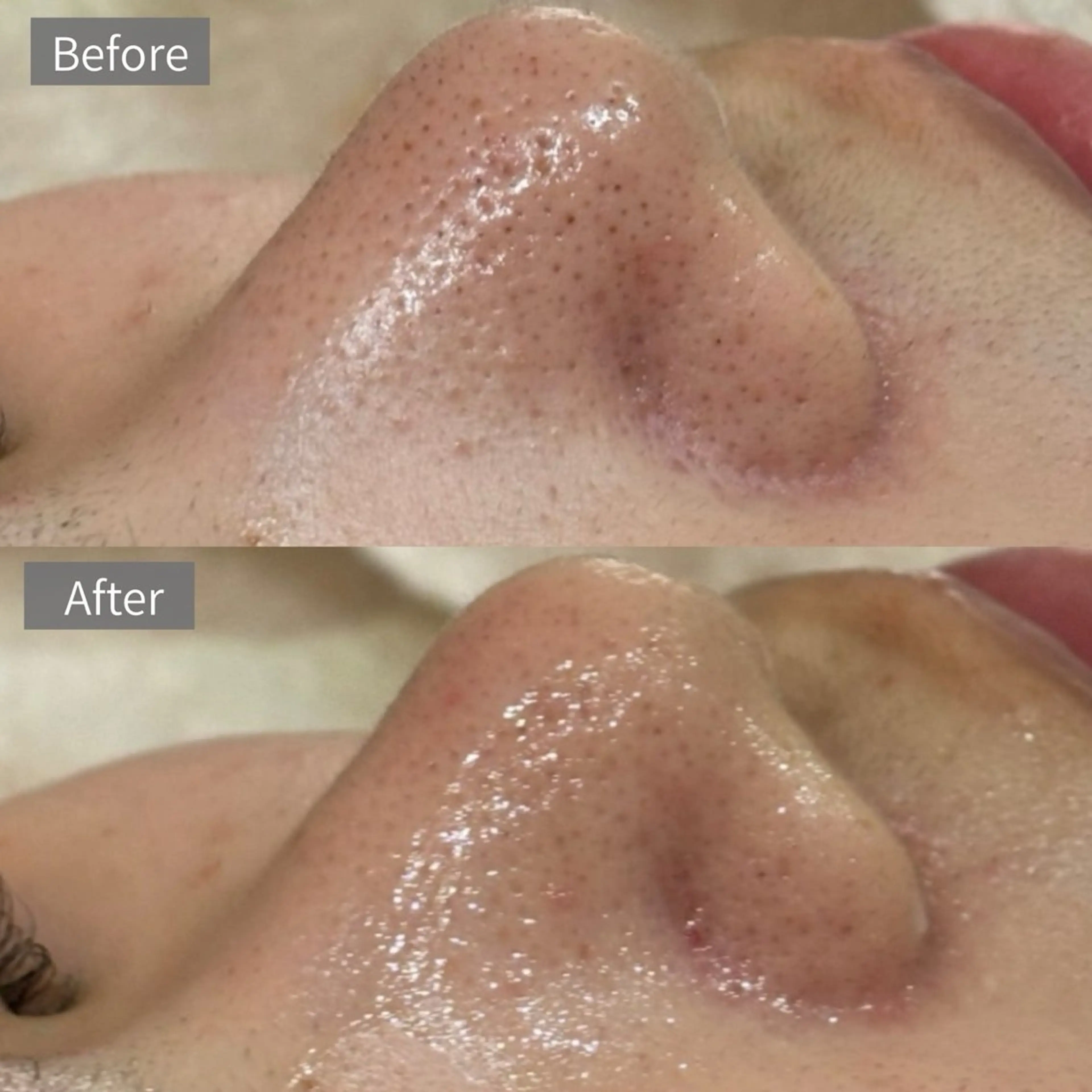 Suu.千種/今池 毛穴洗浄/韓国肌管理の眉毛・アイブロウイメージ