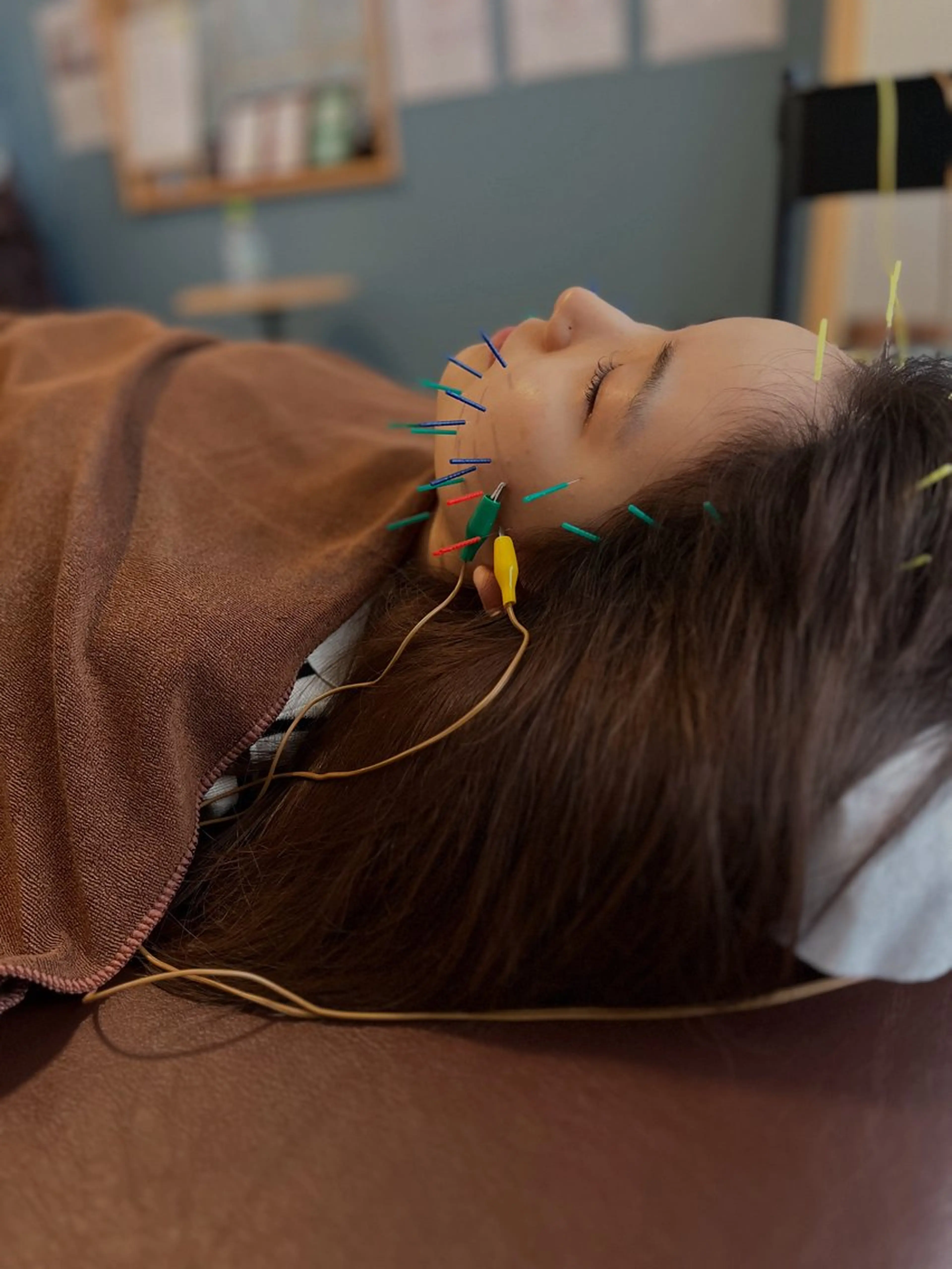 エステ リラク 鍼灸院Blossom所属・鍼灸院 Blossomのエステ・リラクイメージ