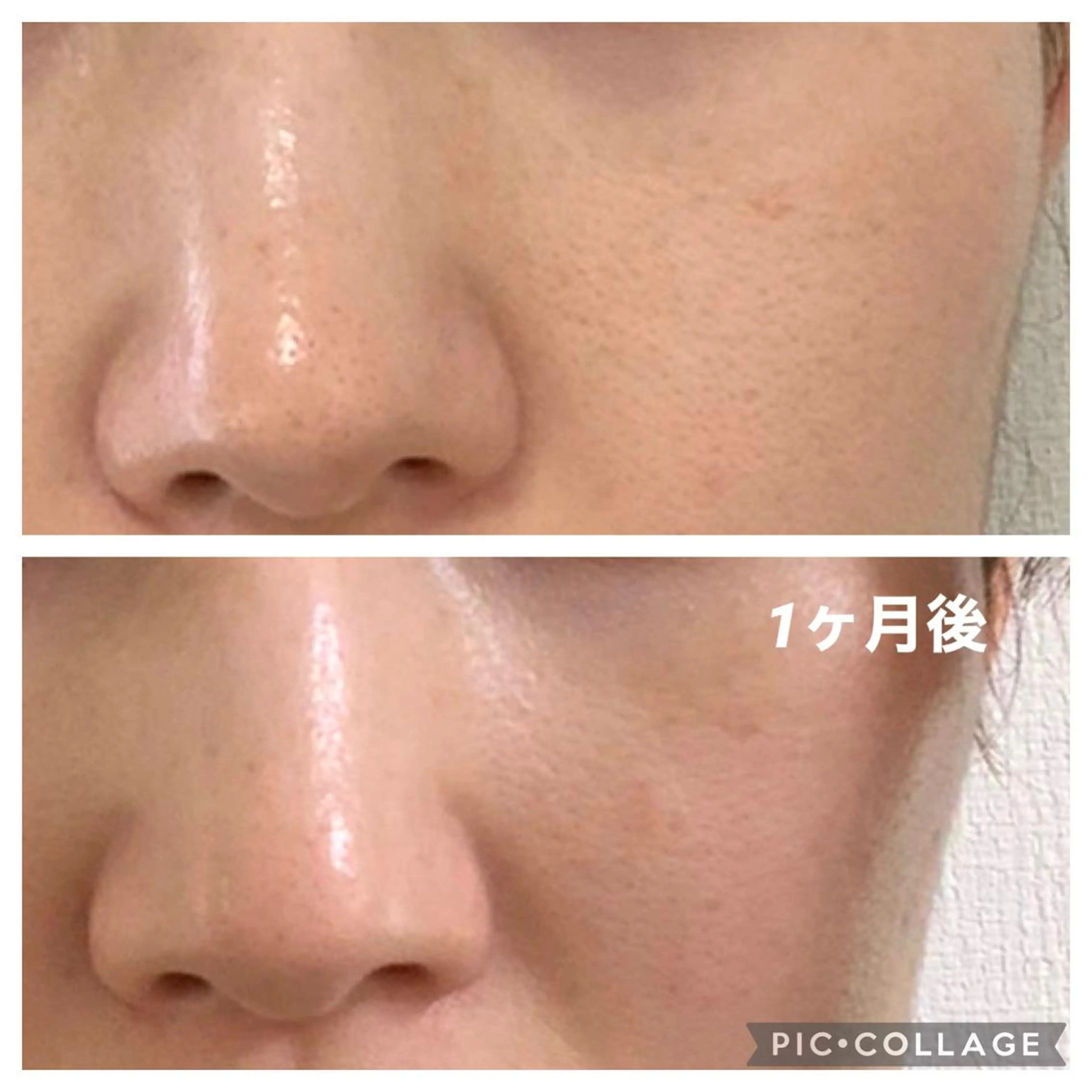 メナード谷口 春香のエステ・リラクイメージ