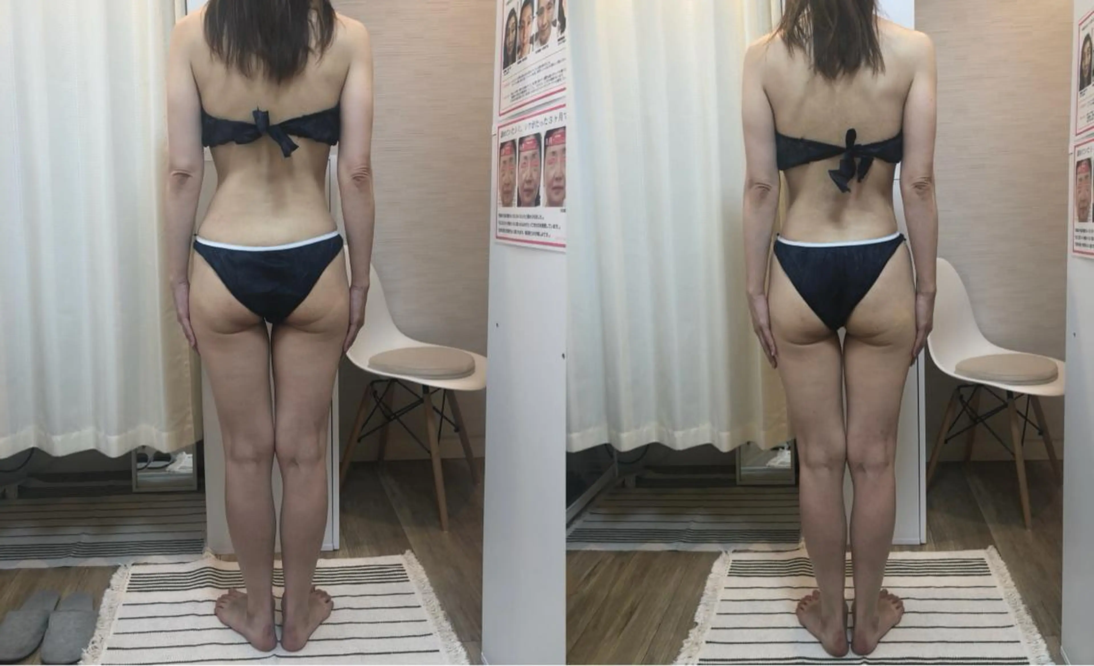 ROOM.S ｜脱毛｜美肌｜ボディのエステ・リラクイメージ