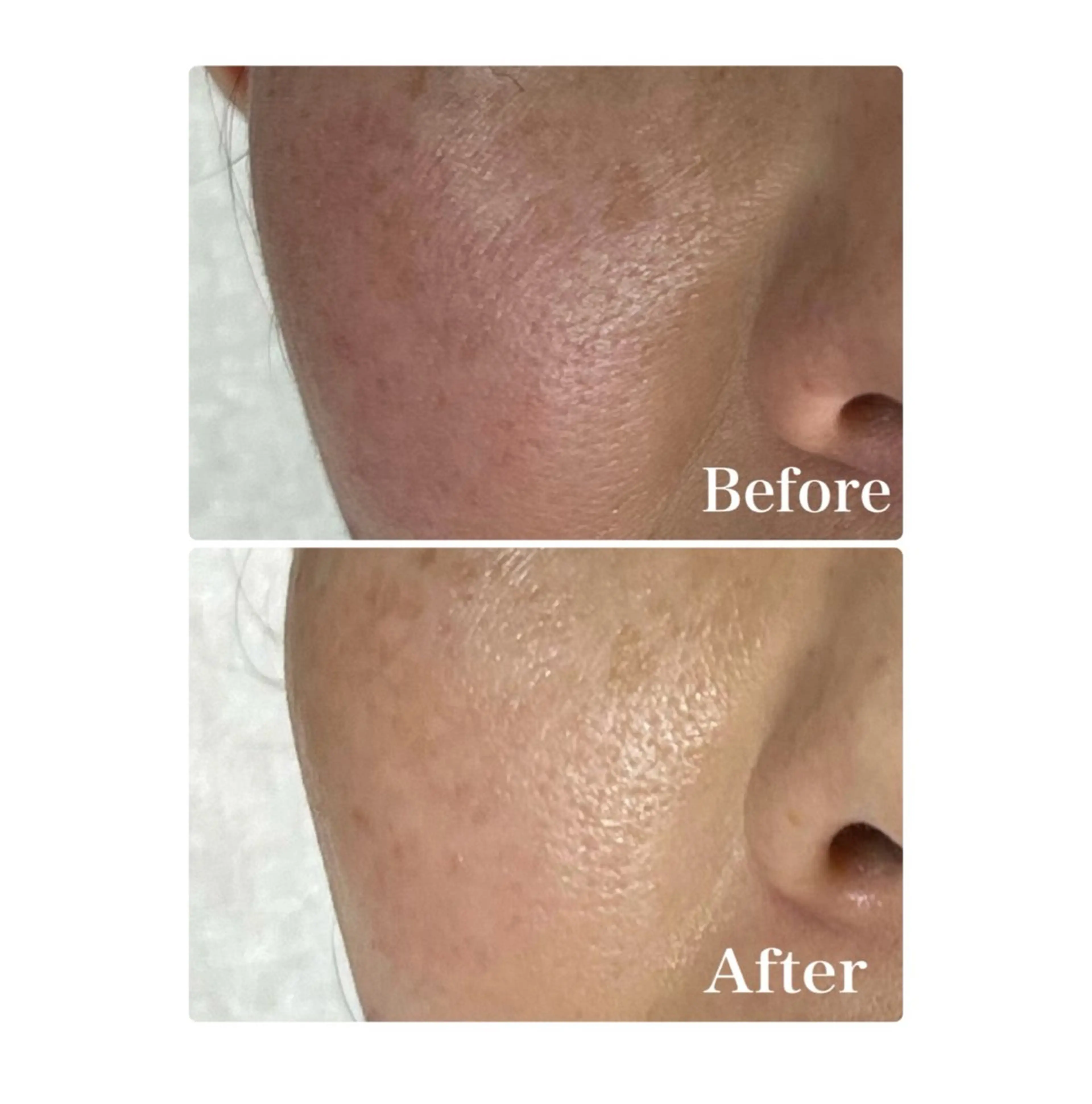 エステ ROR Akariのエステ・リラクイメージ