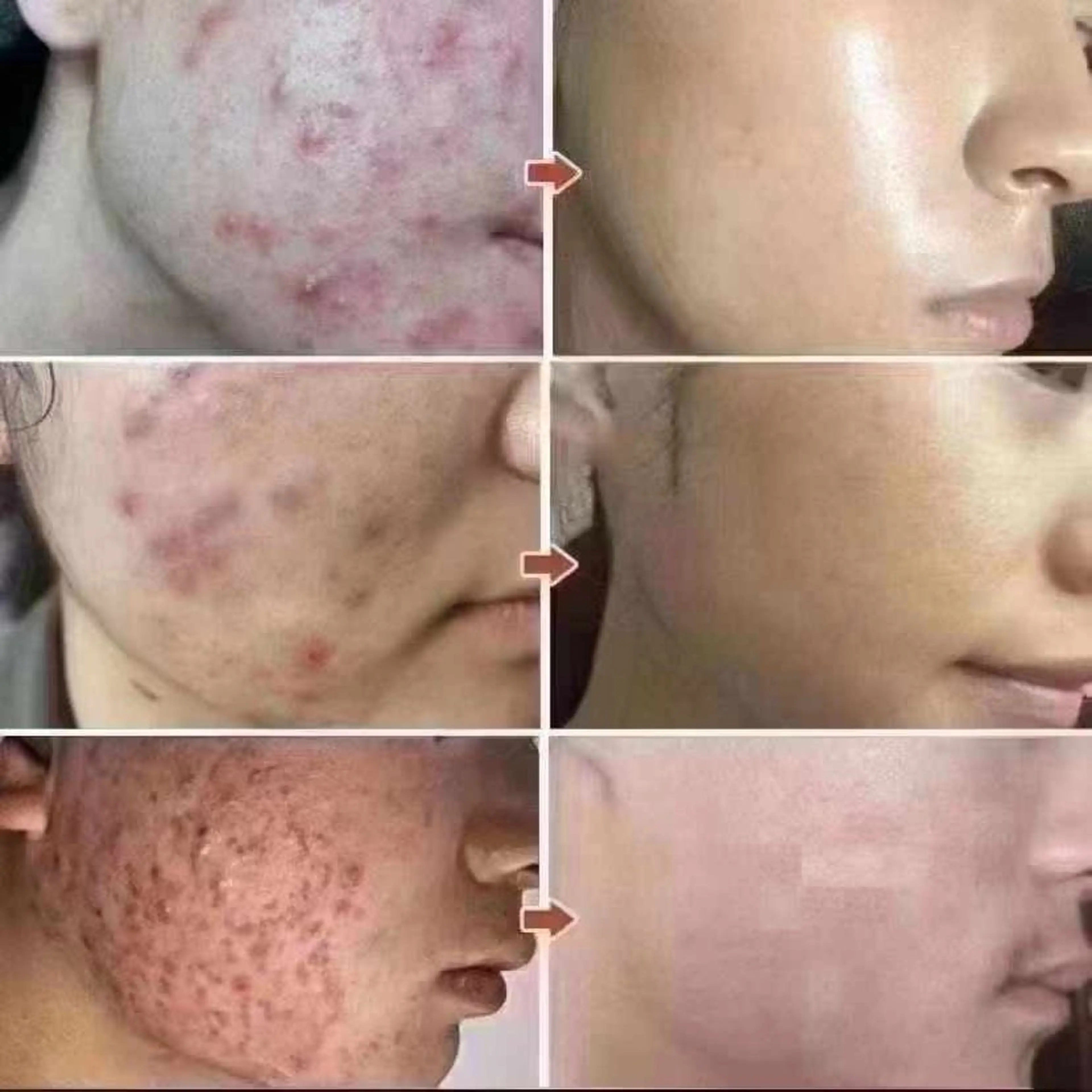 マツエク・マツパ エステ aliaハーブ水光店 エステティシャン募集のエステ・リラクイメージ