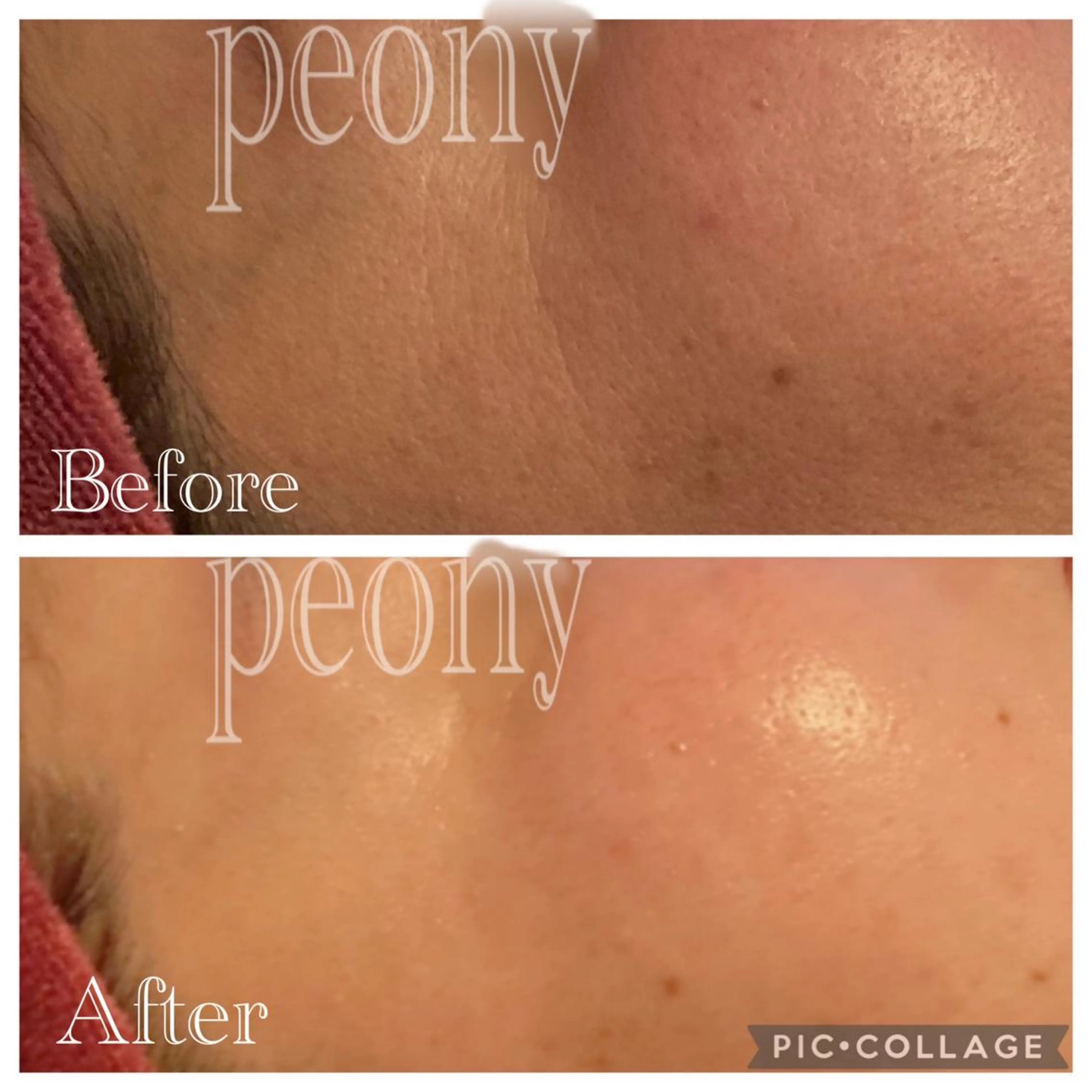 デトックス美容専門サロンｐｅｏｎｙ所属・デトックス美容専門 サロンｐｅｏｎｙのエステ・リラクイメージ