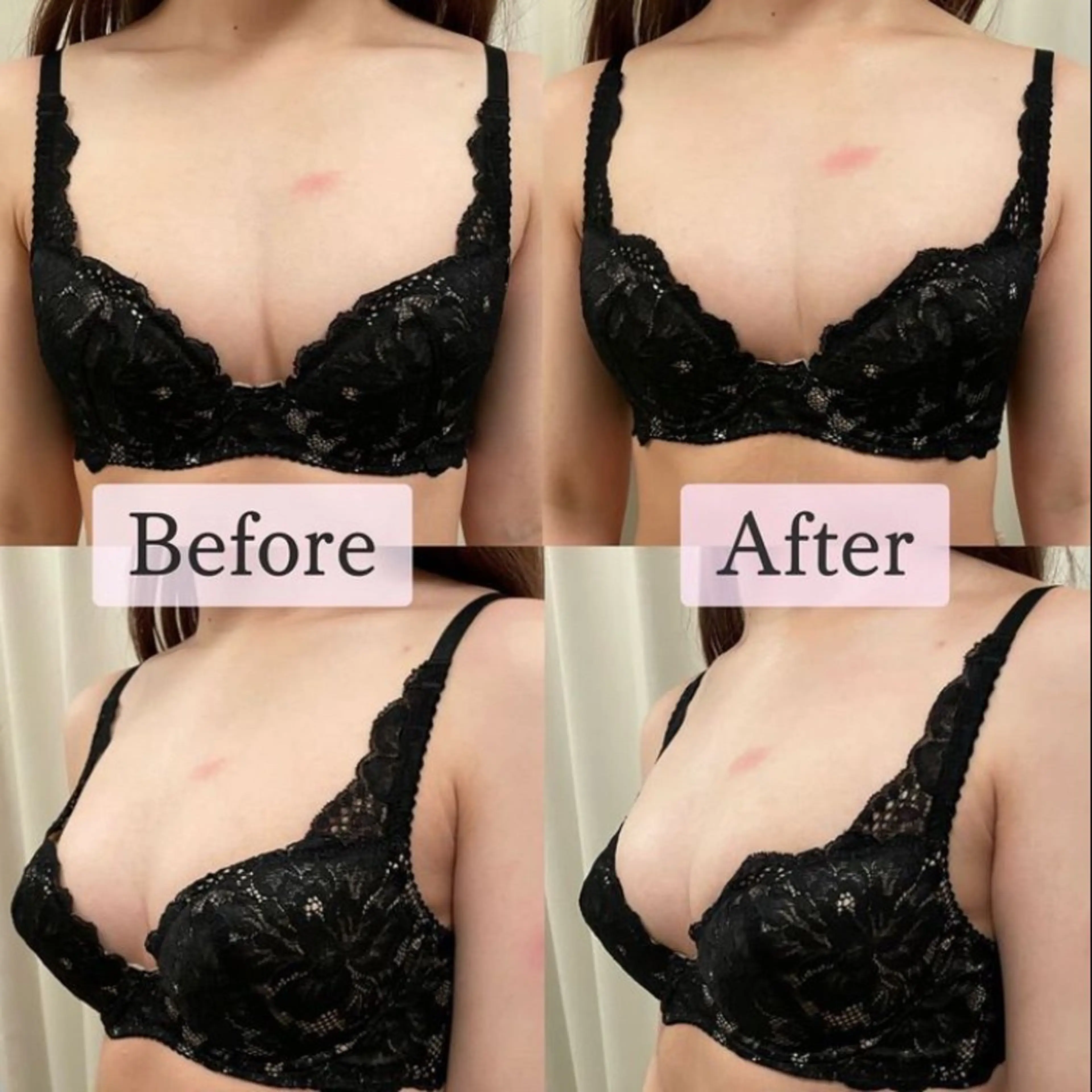 エステ ポテンツァ&針美容 バストアップ専門店のエステ・リラクイメージ