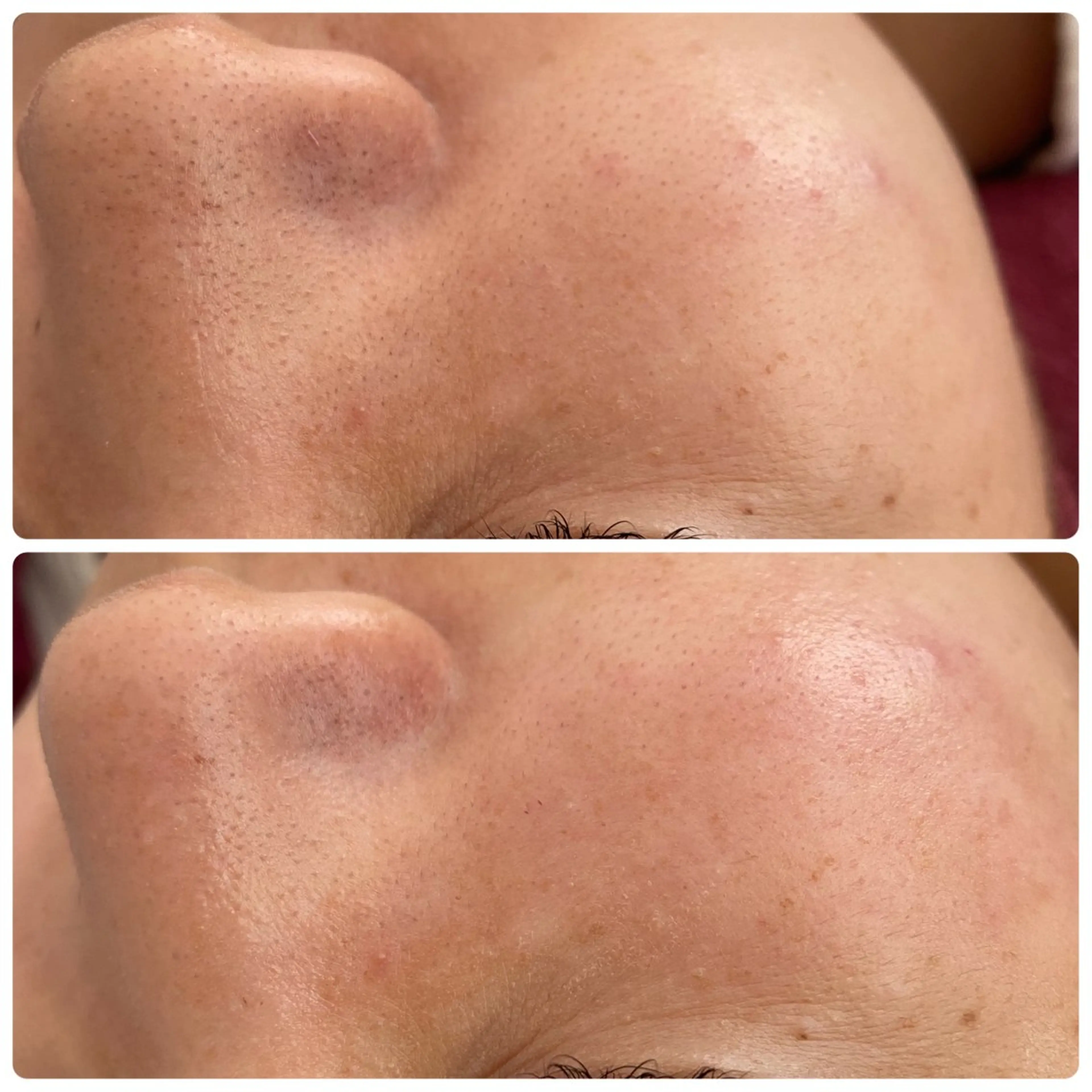 エステ REVI取扱・肌悩み 毛穴Chalonのエステ・リラクイメージ