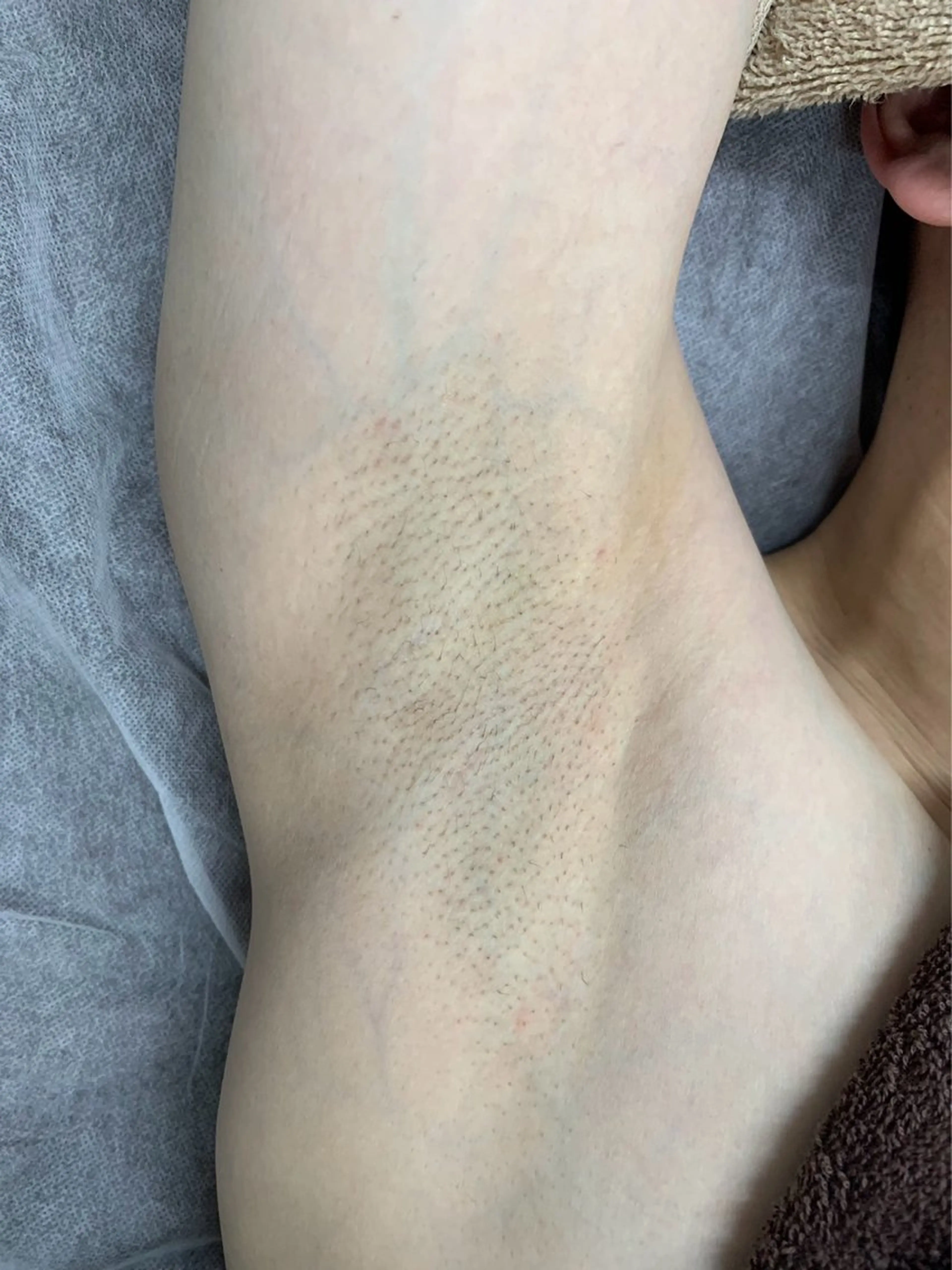 メンズ 脱毛 脱毛サロン BRIDGE橋本のエステ・リラクイメージ