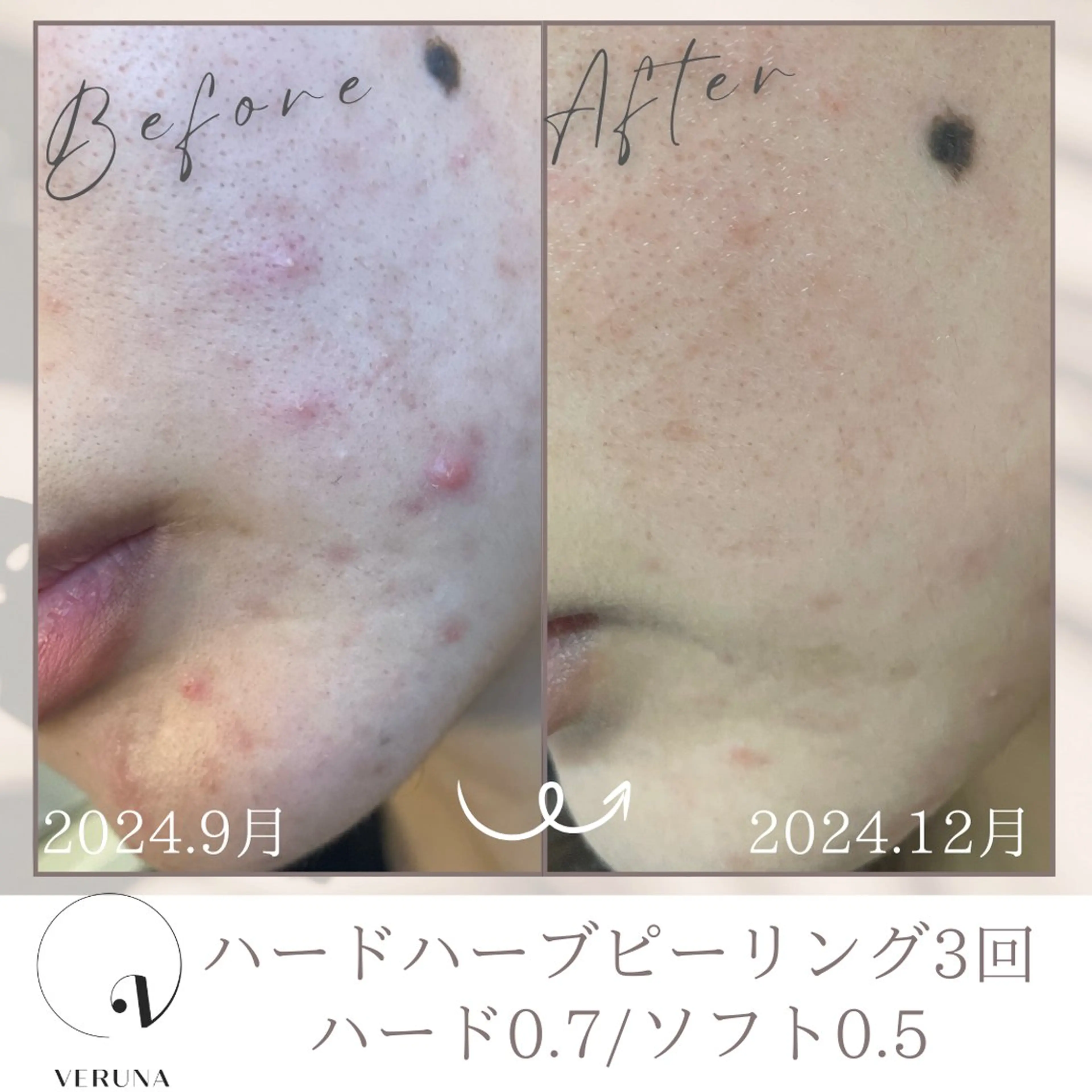 エステ 毛穴改善サロン d'Alba大阪住吉のエステ・リラクイメージ