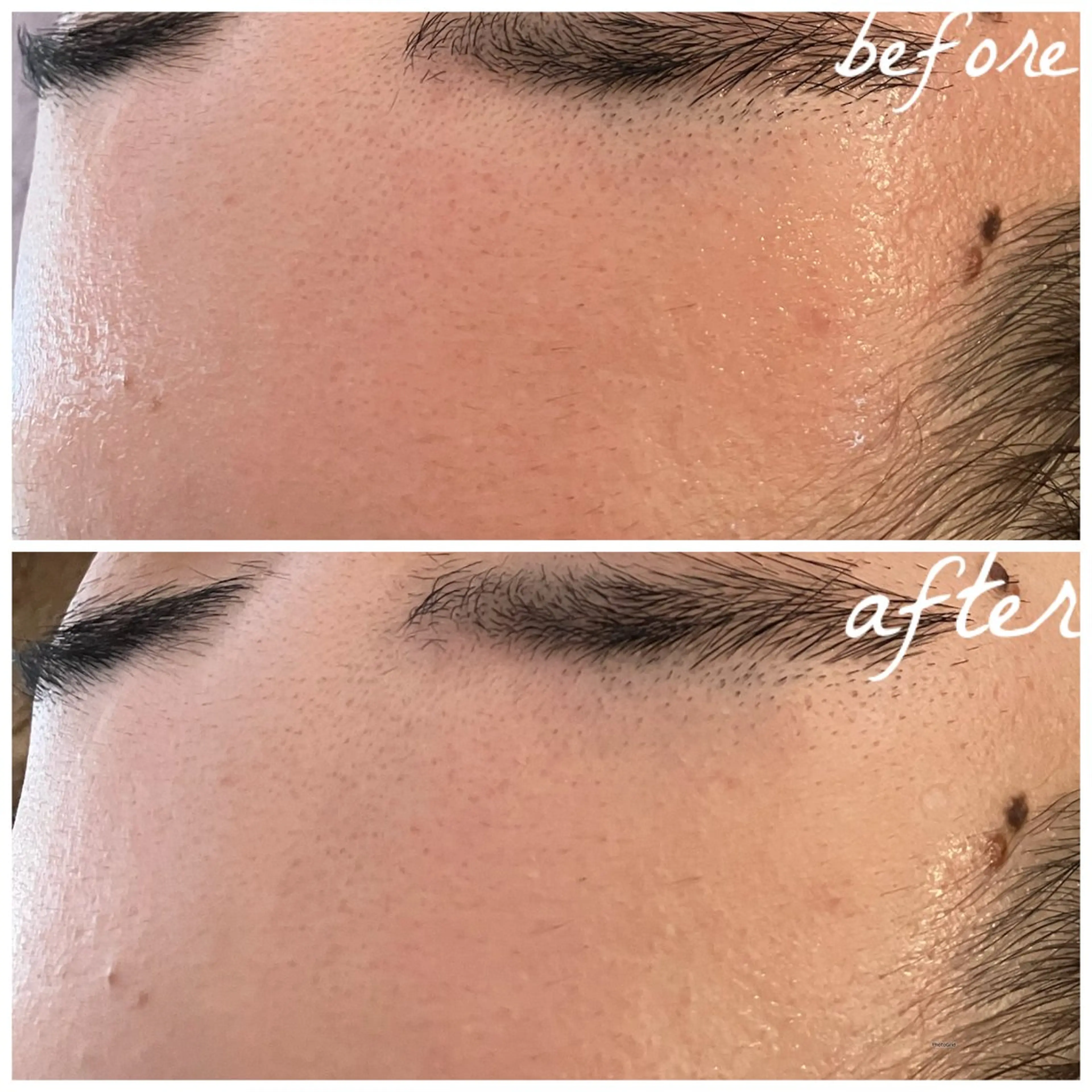 メンズ エステ メナード岐阜市茜部 杉浦のエステ・リラクイメージ