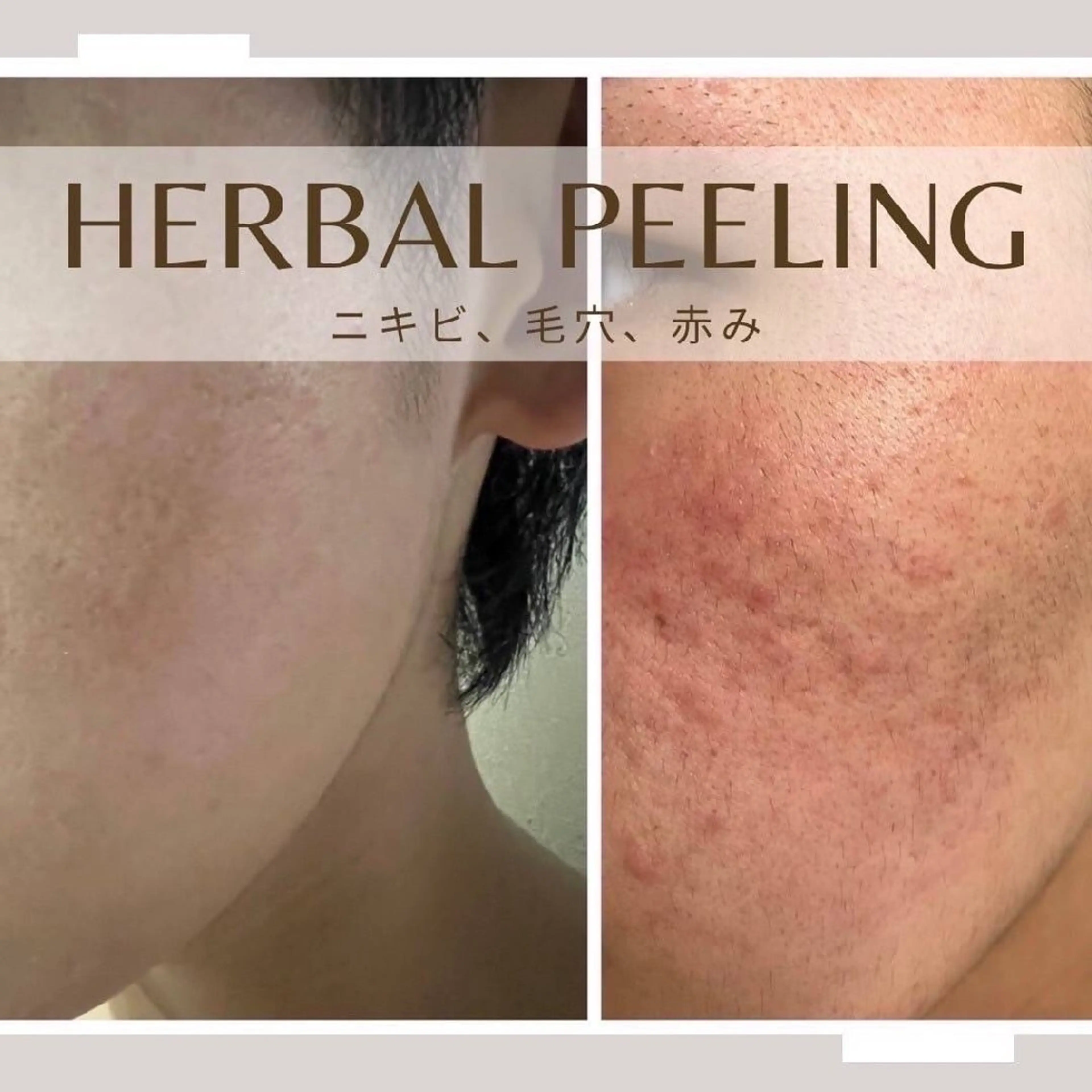 アゲハビューティー クリニックの眉毛・アイブロウイメージ