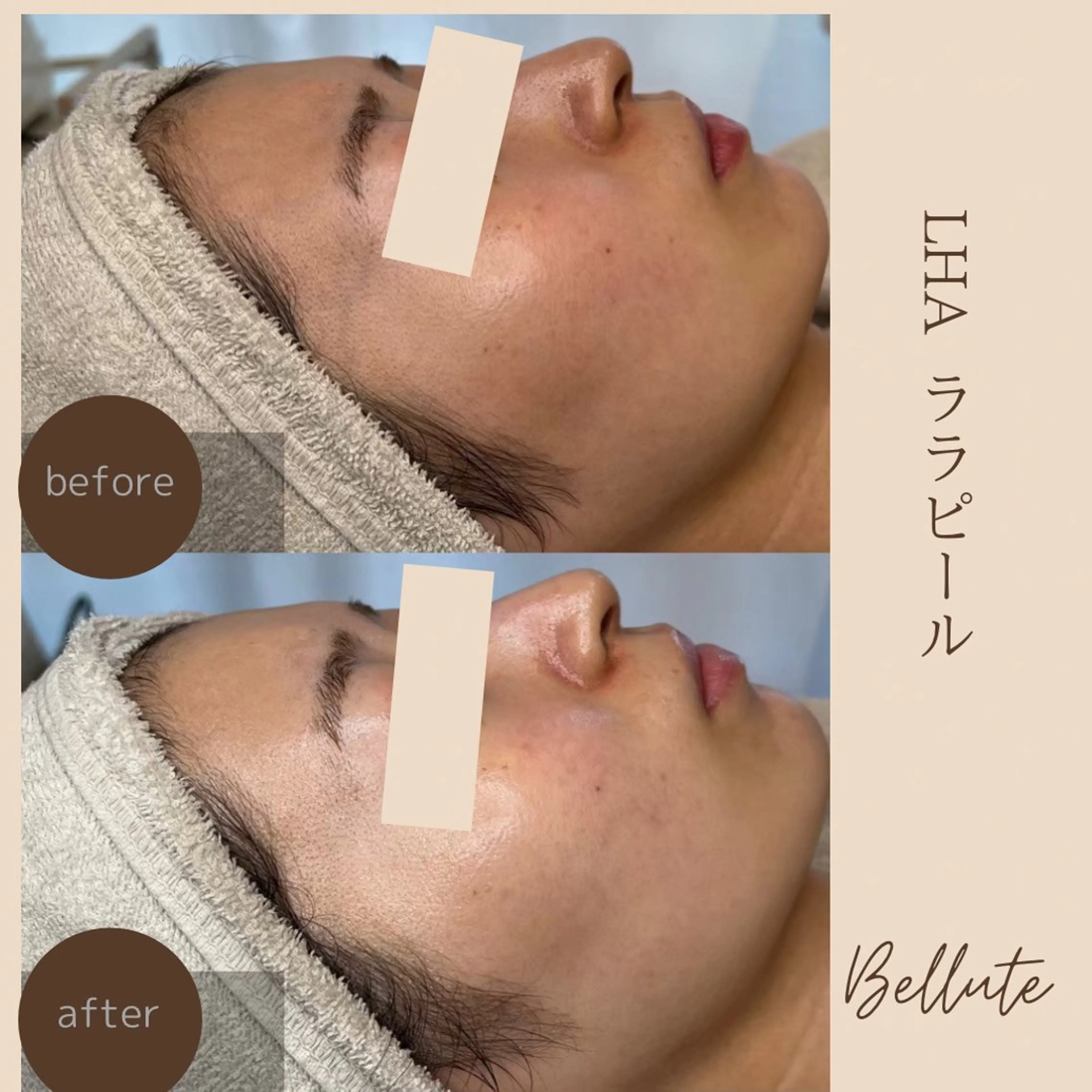 エステ ピーリング専門店 Belluteのエステ・リラクイメージ