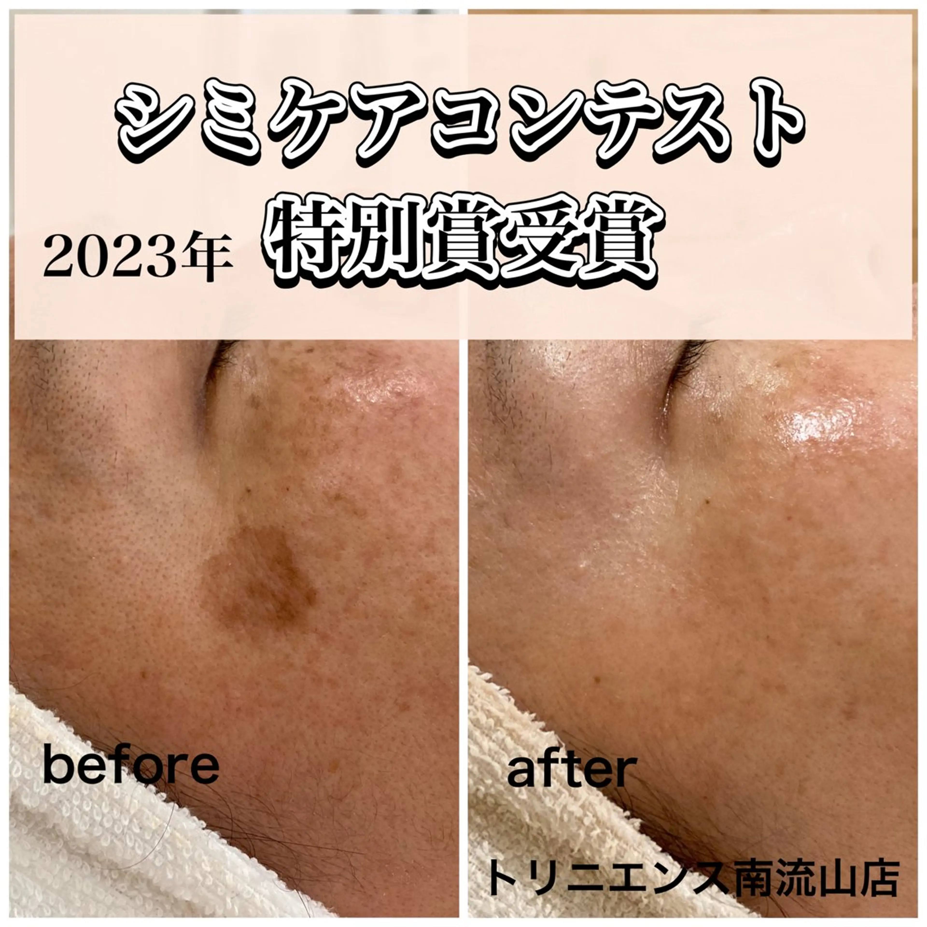 TRINIENCE 南流山店のエステ・リラクイメージ