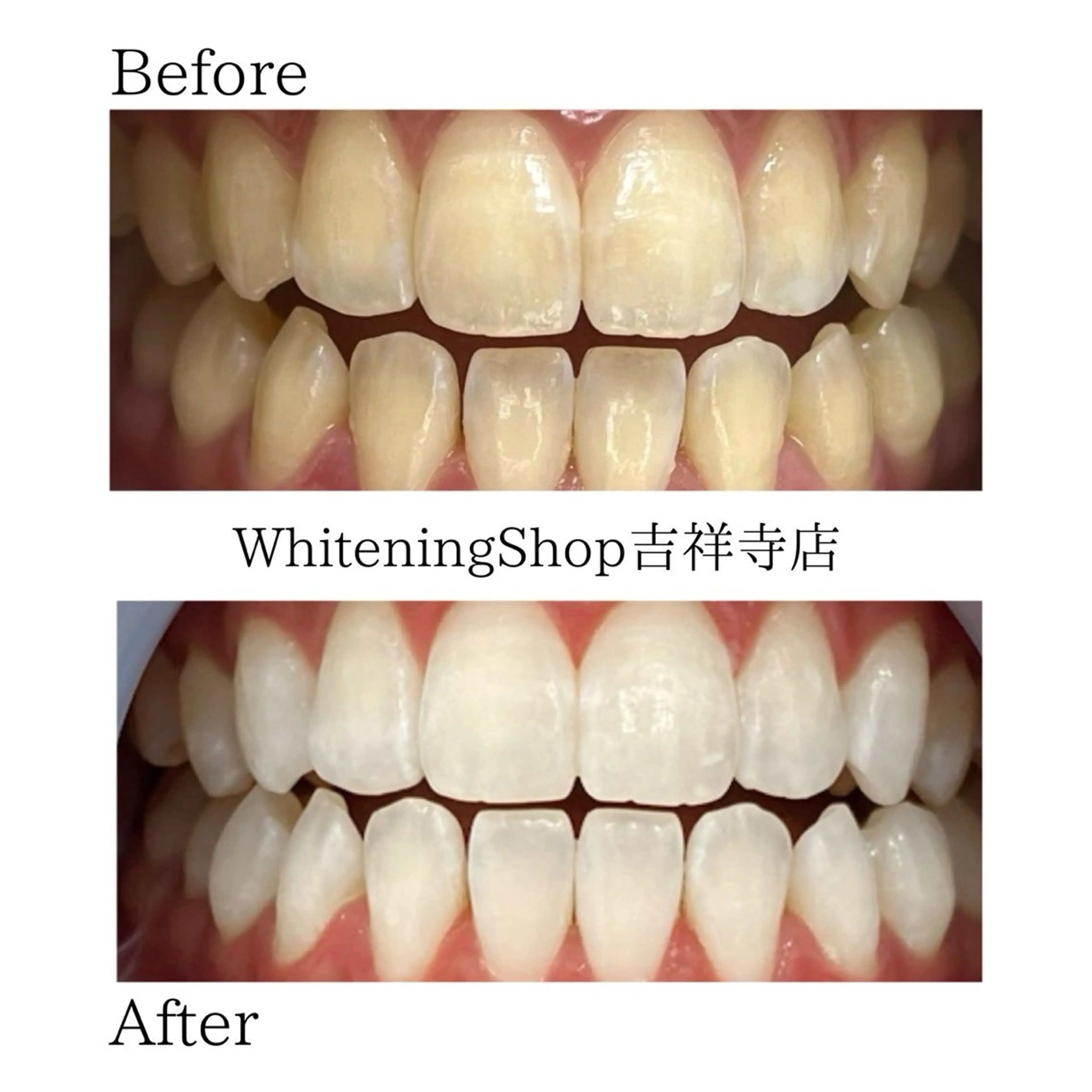 エステ リラク ホワイトニング ショップ吉祥寺店のエステ・リラクイメージ