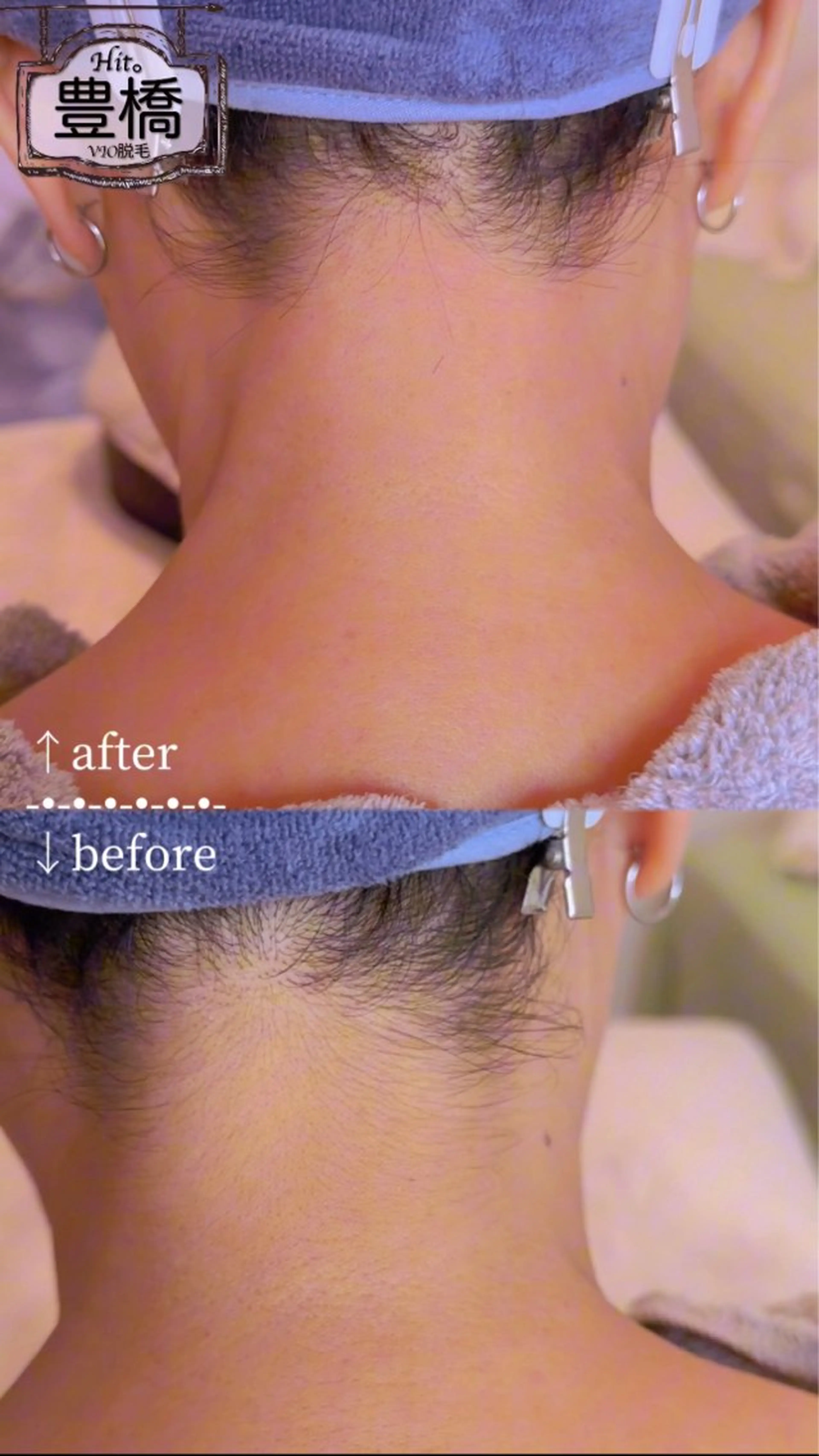 Hitomi シュガーリング豊橋のその他イメージ