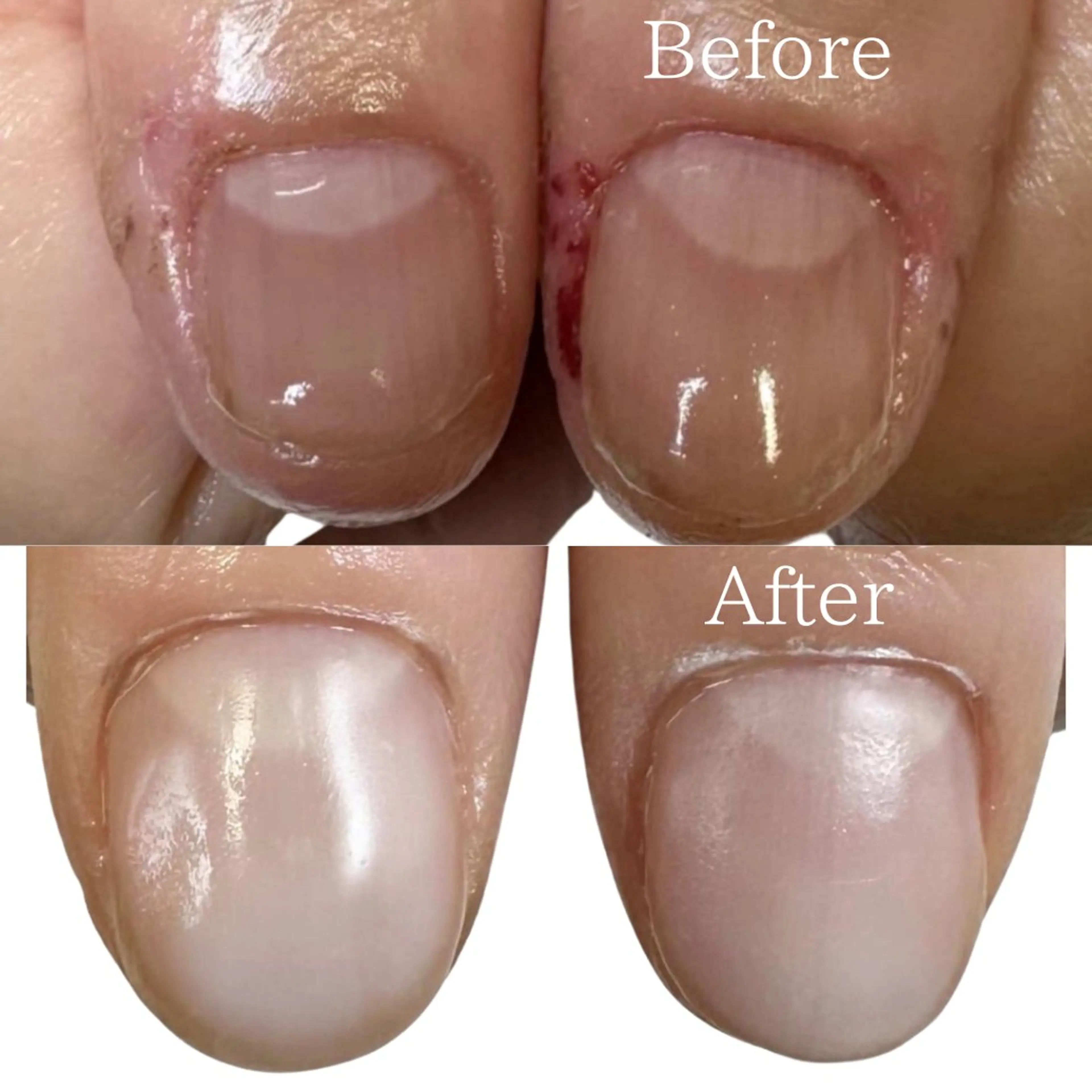 ネイル ハンドネイル ハンドケア 𝐴𝑁𝑈𝐸 トラブル爪育成専門のネイルデザイン