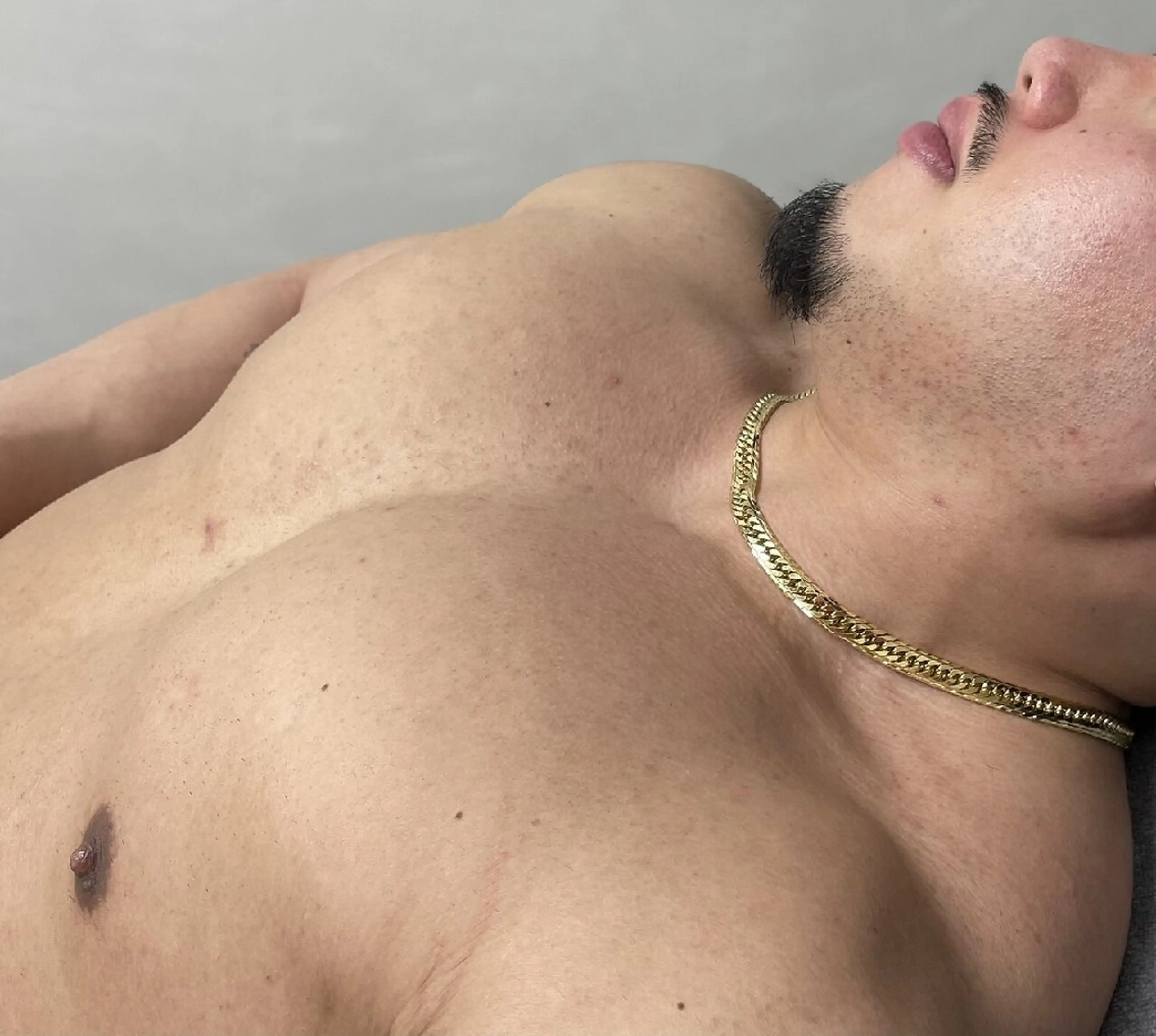 メンズ脱毛🪒襟足✨の写真