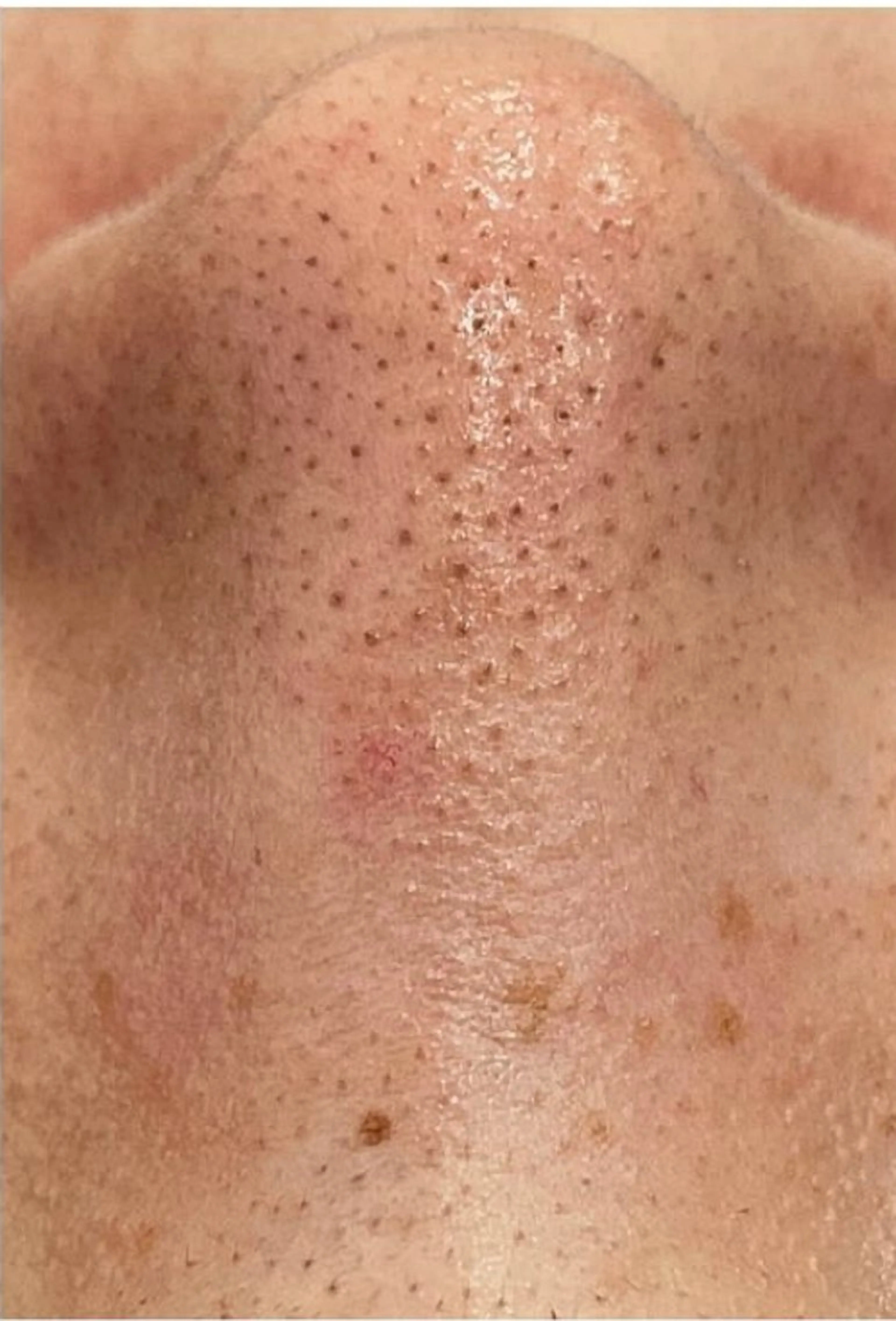 全身脱毛&毛穴洗浄 ビューティー五反田のエステ・リラクイメージ