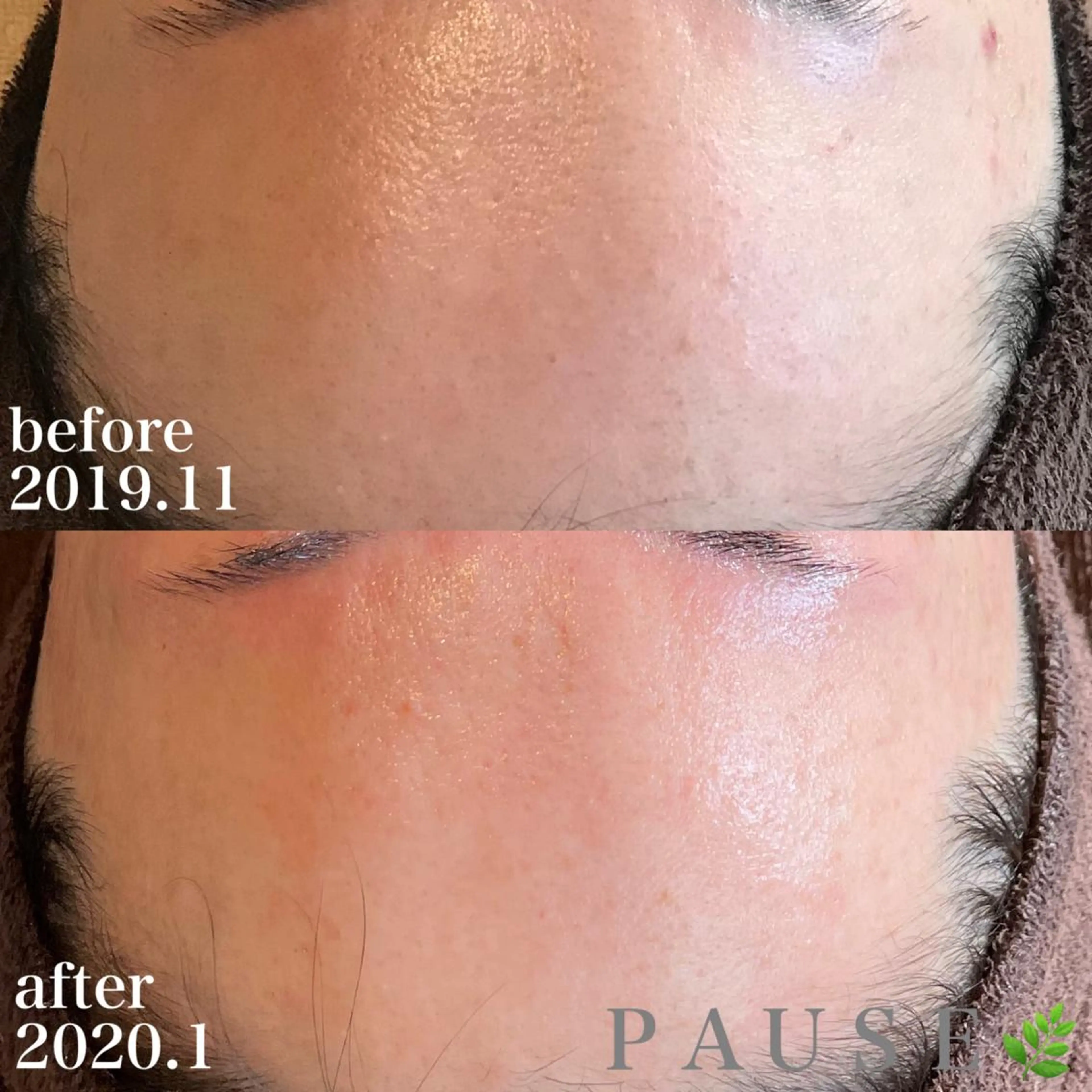 エステ 浜野 恵美のエステ・リラクイメージ