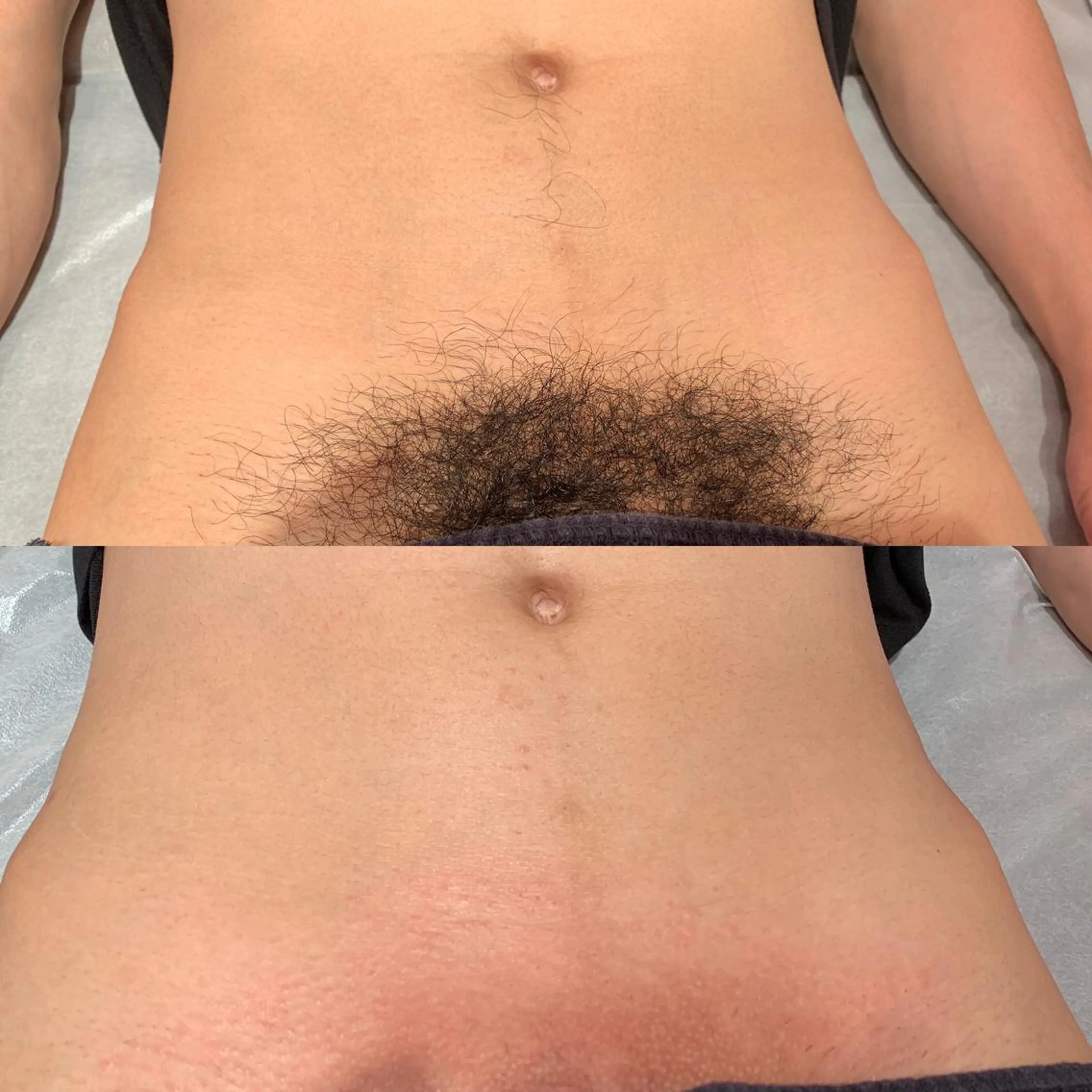 メンズ 男性施術者による 光脱毛×ワックス脱毛のエステ・リラクイメージ