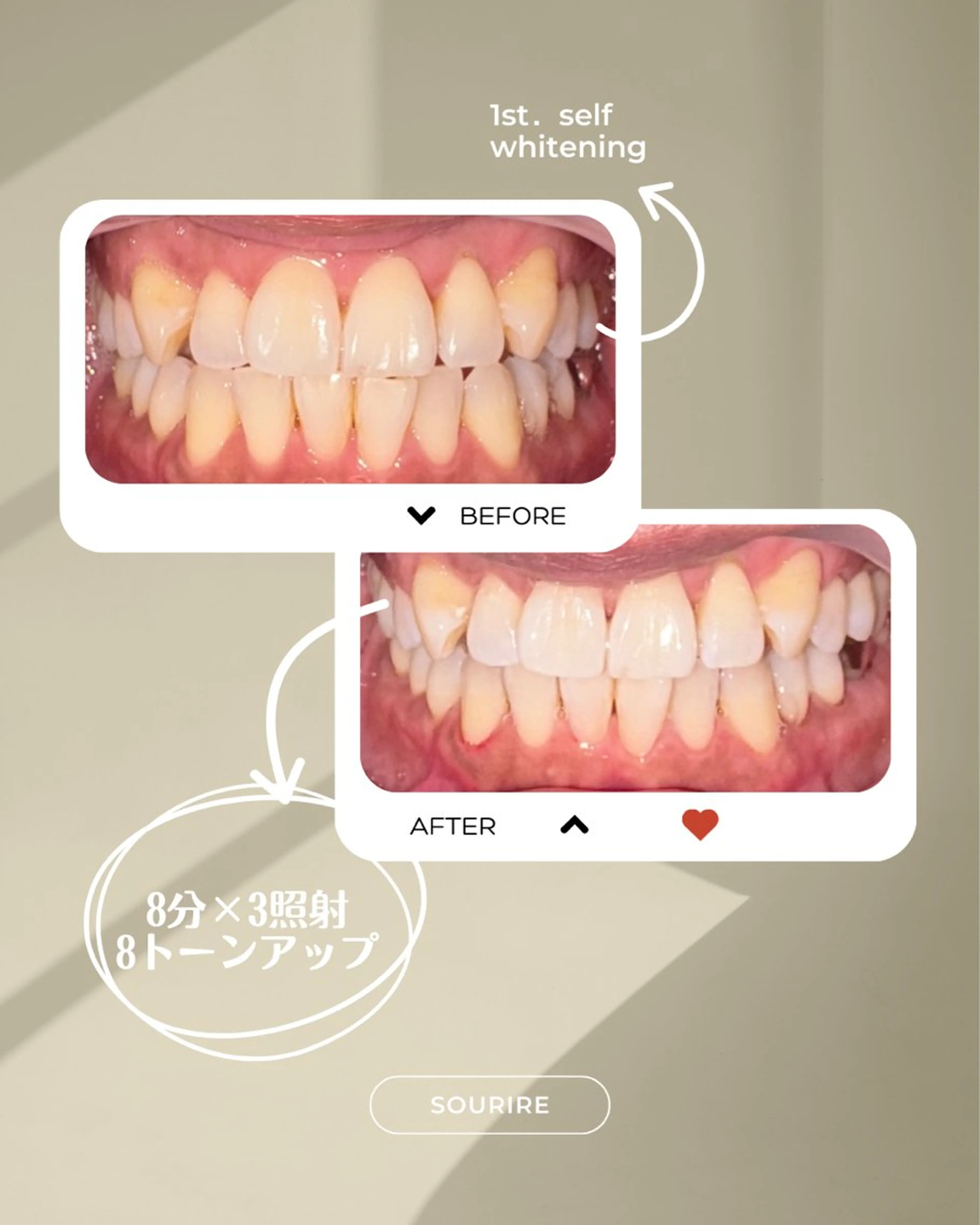 加藤 愛菜のその他イメージ