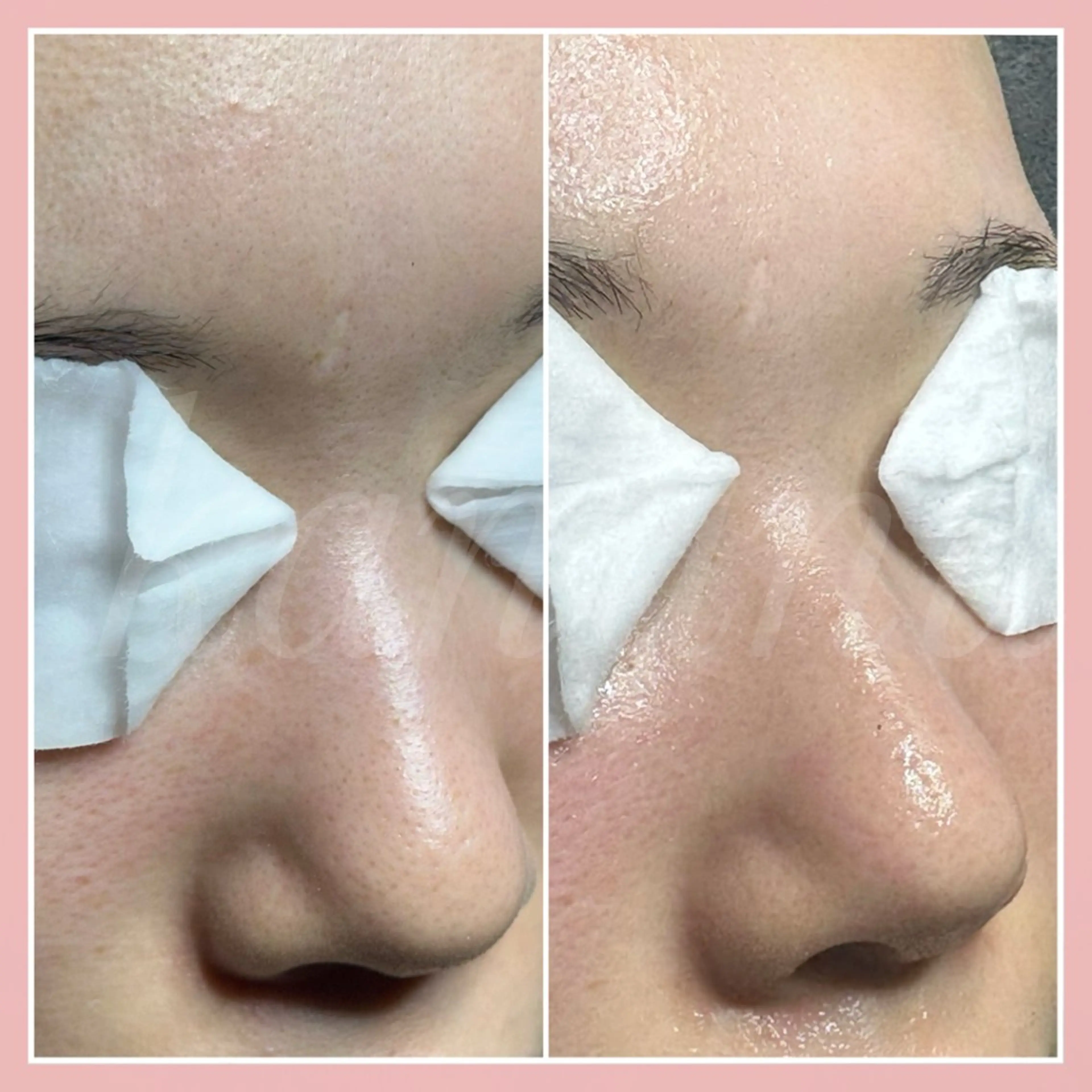 エステ kanunu♡mana所属・豊橋/毛穴特化エステ 深層デトックスリンパのエステ・リラクイメージ