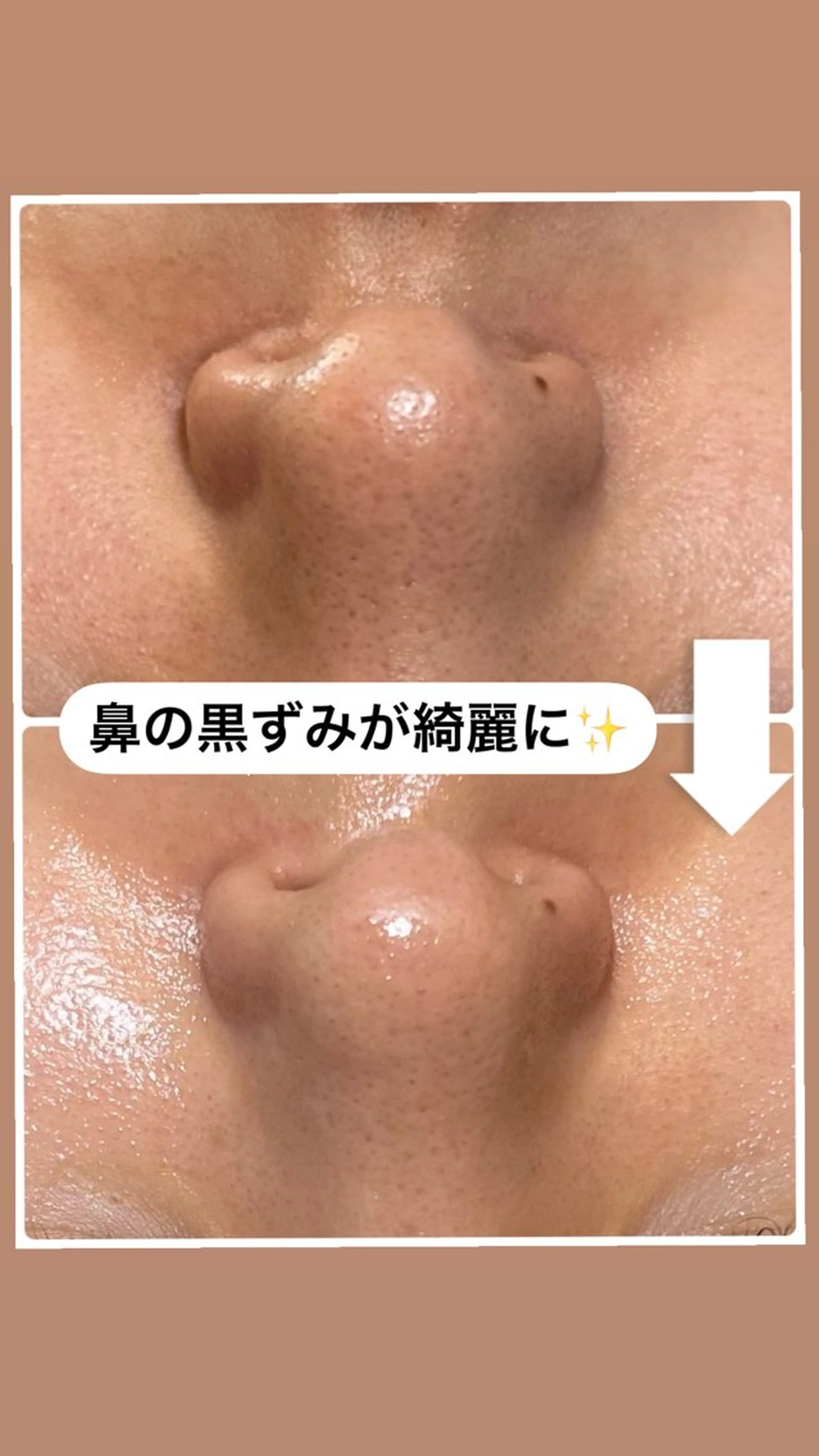 W MISATOのエステ・リラクイメージ