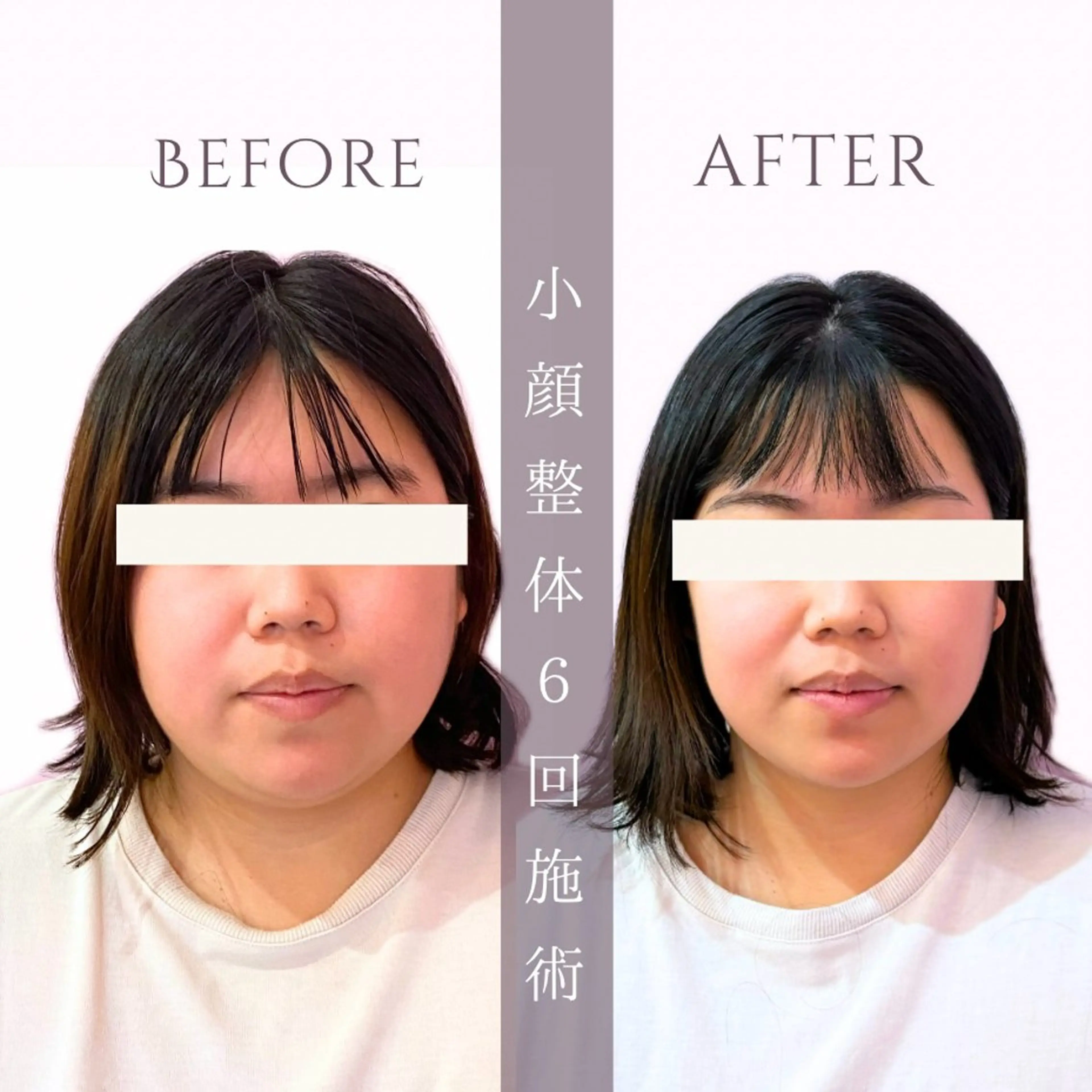 haru. 川越のエステ・リラクイメージ