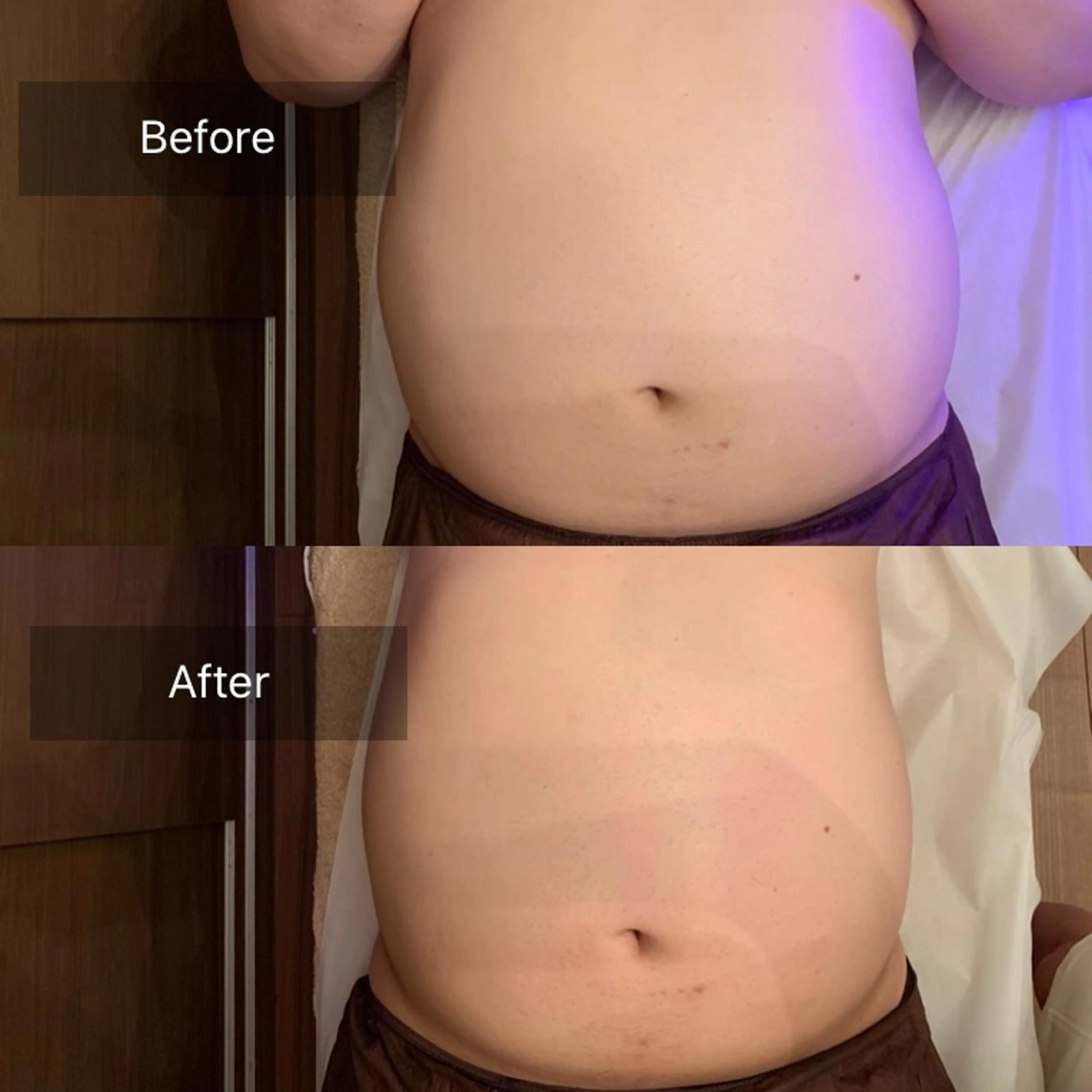 小顔とシミケア🪽 /Salon Mのエステ・リラクイメージ