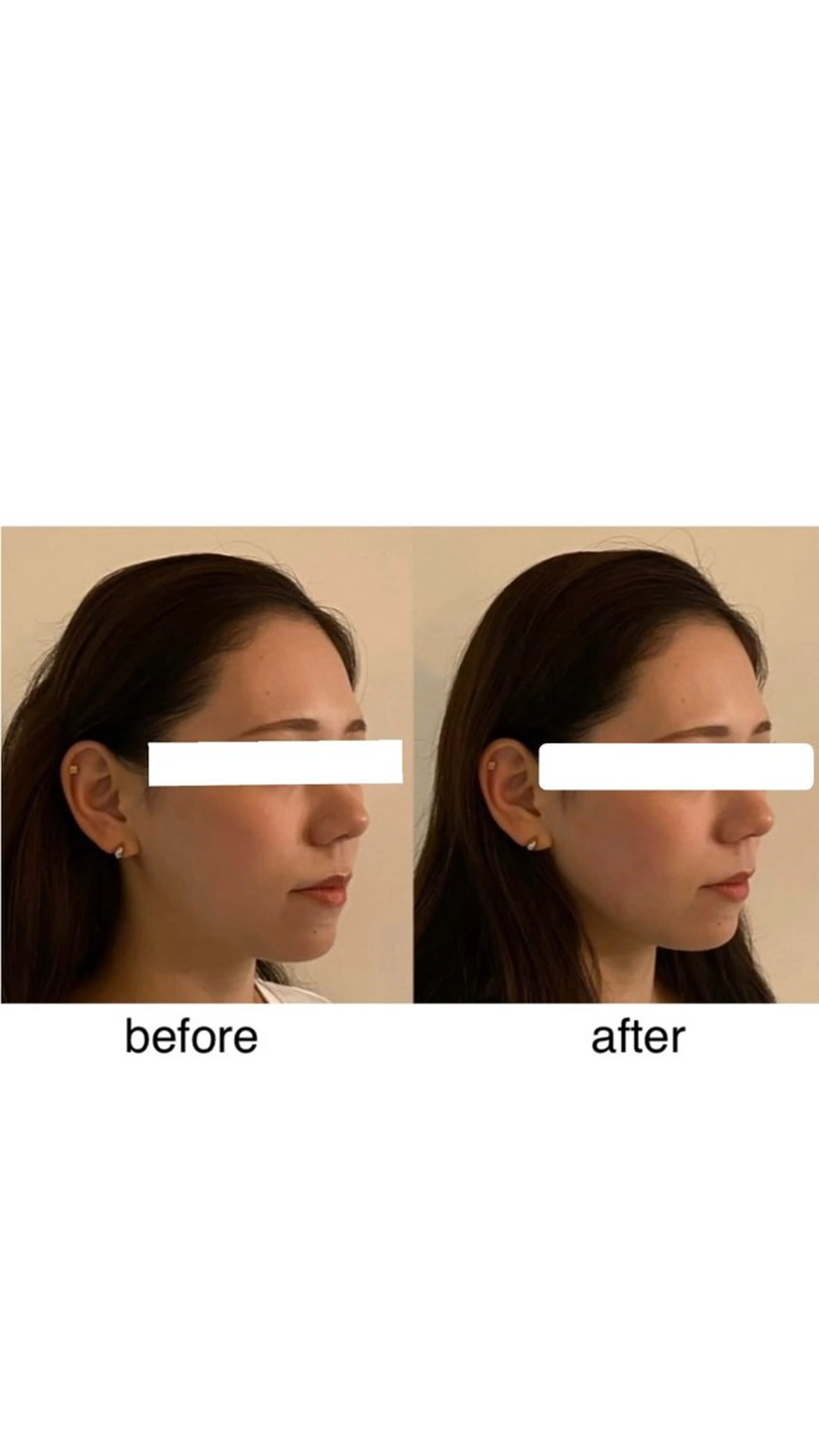 エステ 美容小顔・整体 ・美容鍼　SAKUのエステ・リラクイメージ