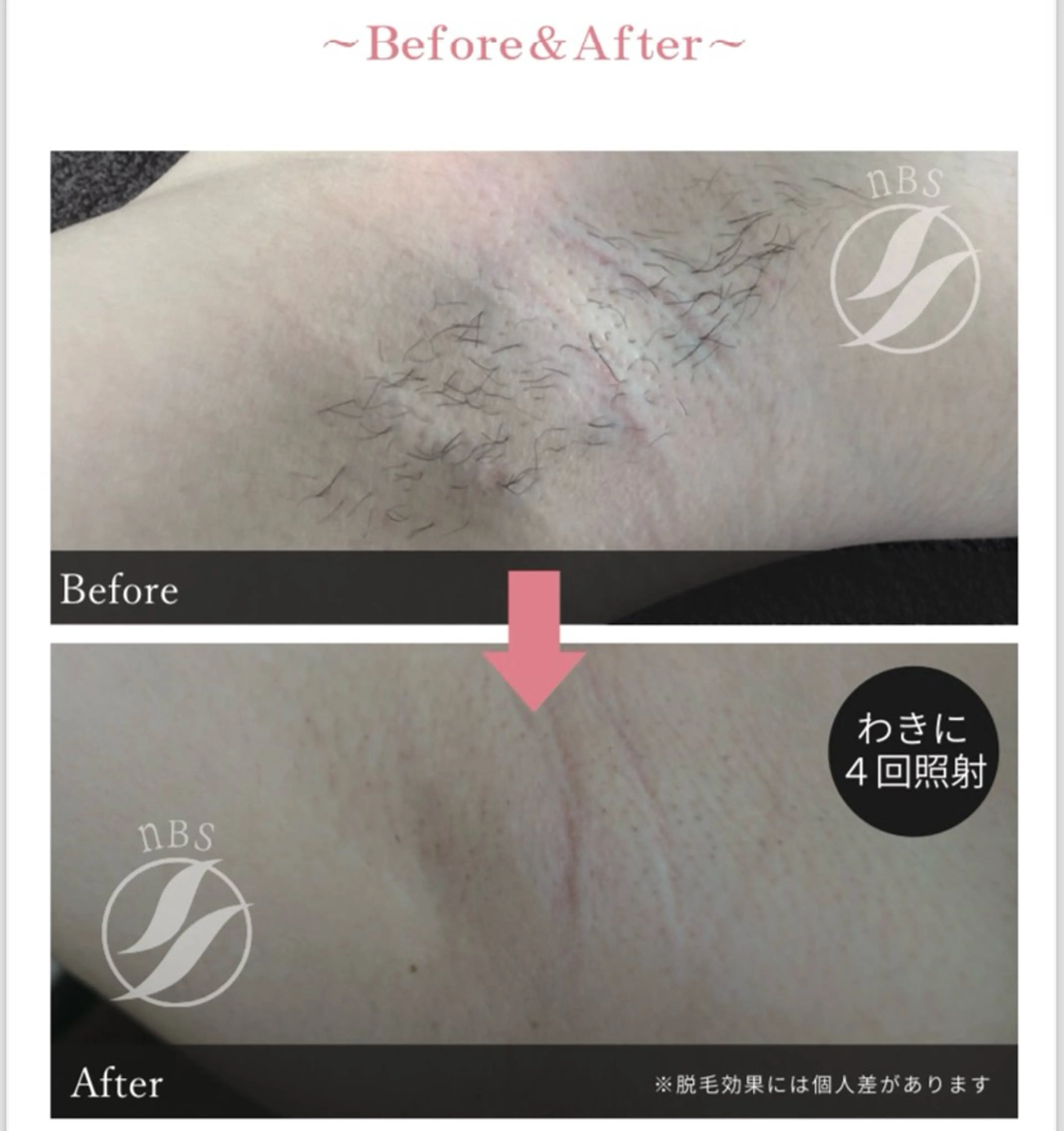 VIERU YURIのネイルデザイン