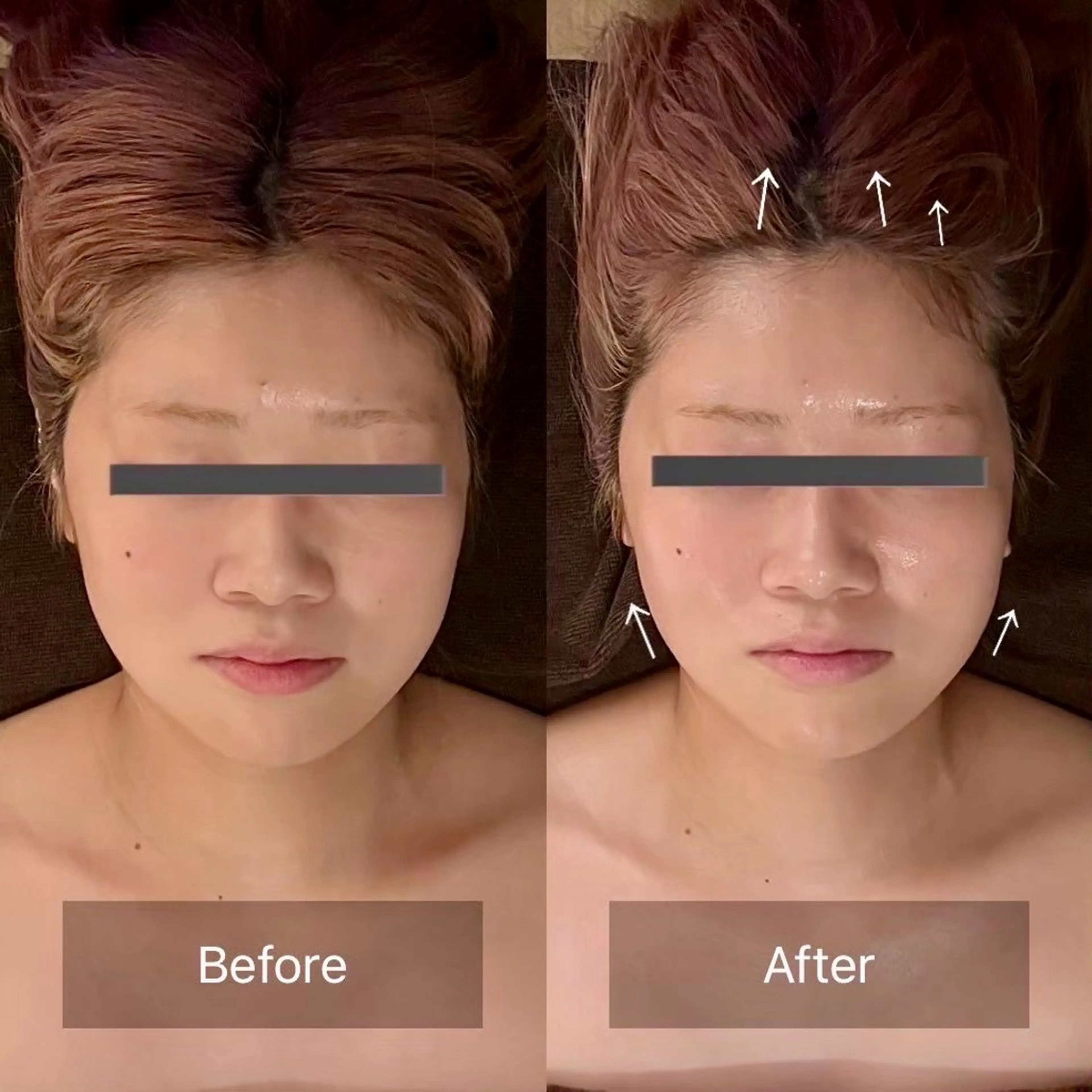 エステ リラク kogao&head Linoasのエステ・リラクイメージ