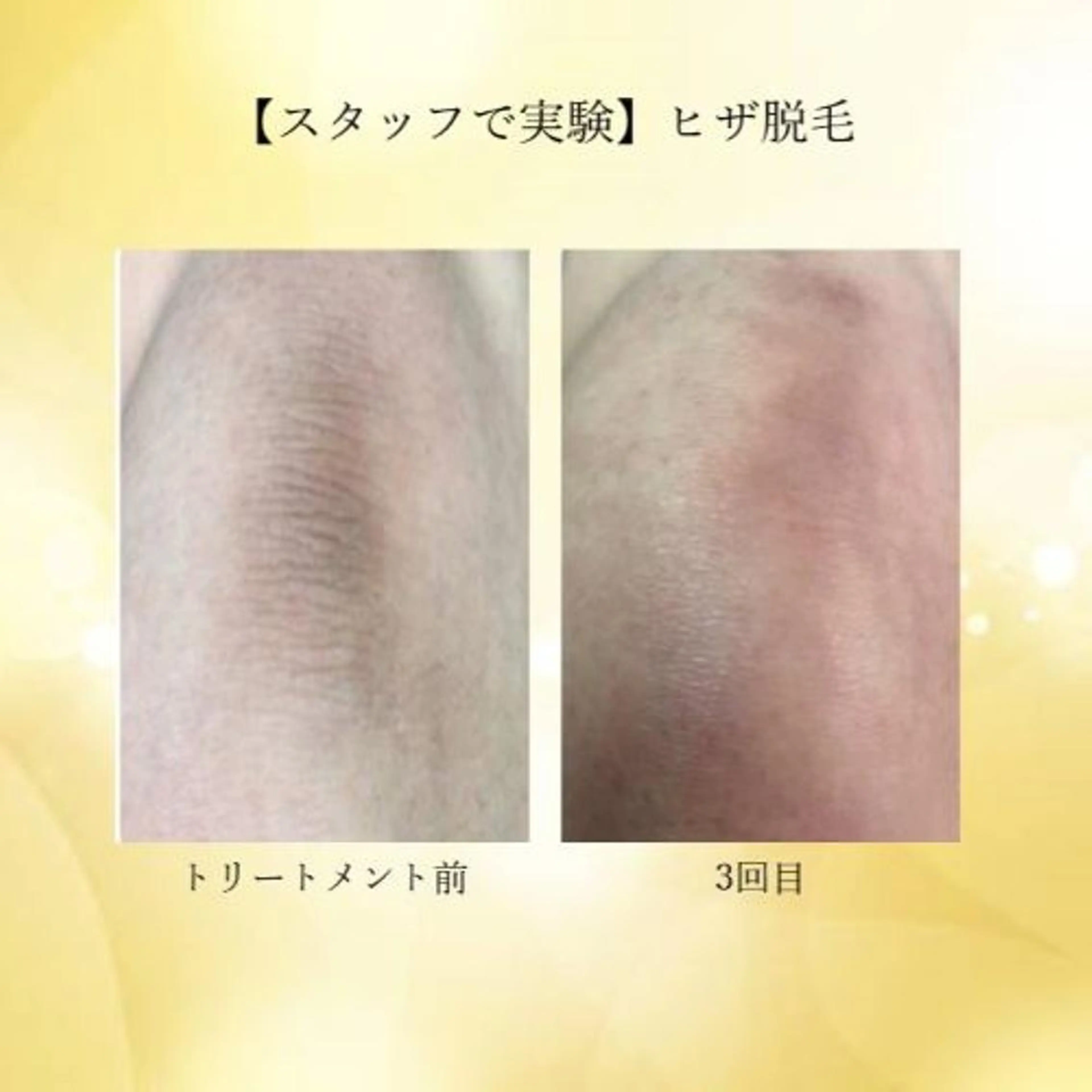 ふじわら ひかりのその他イメージ