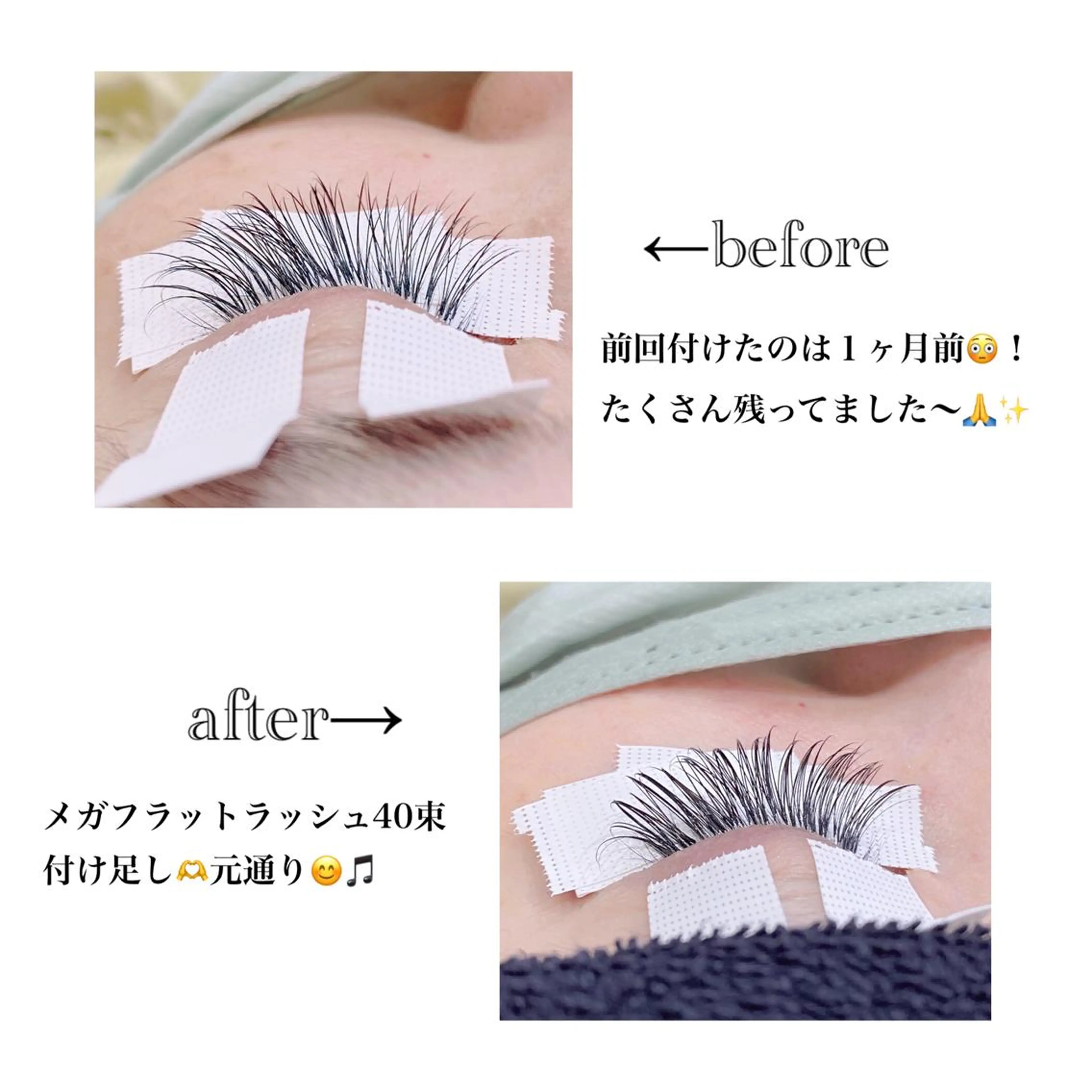 付けたし🍌メガフラットラッシュ30束の写真