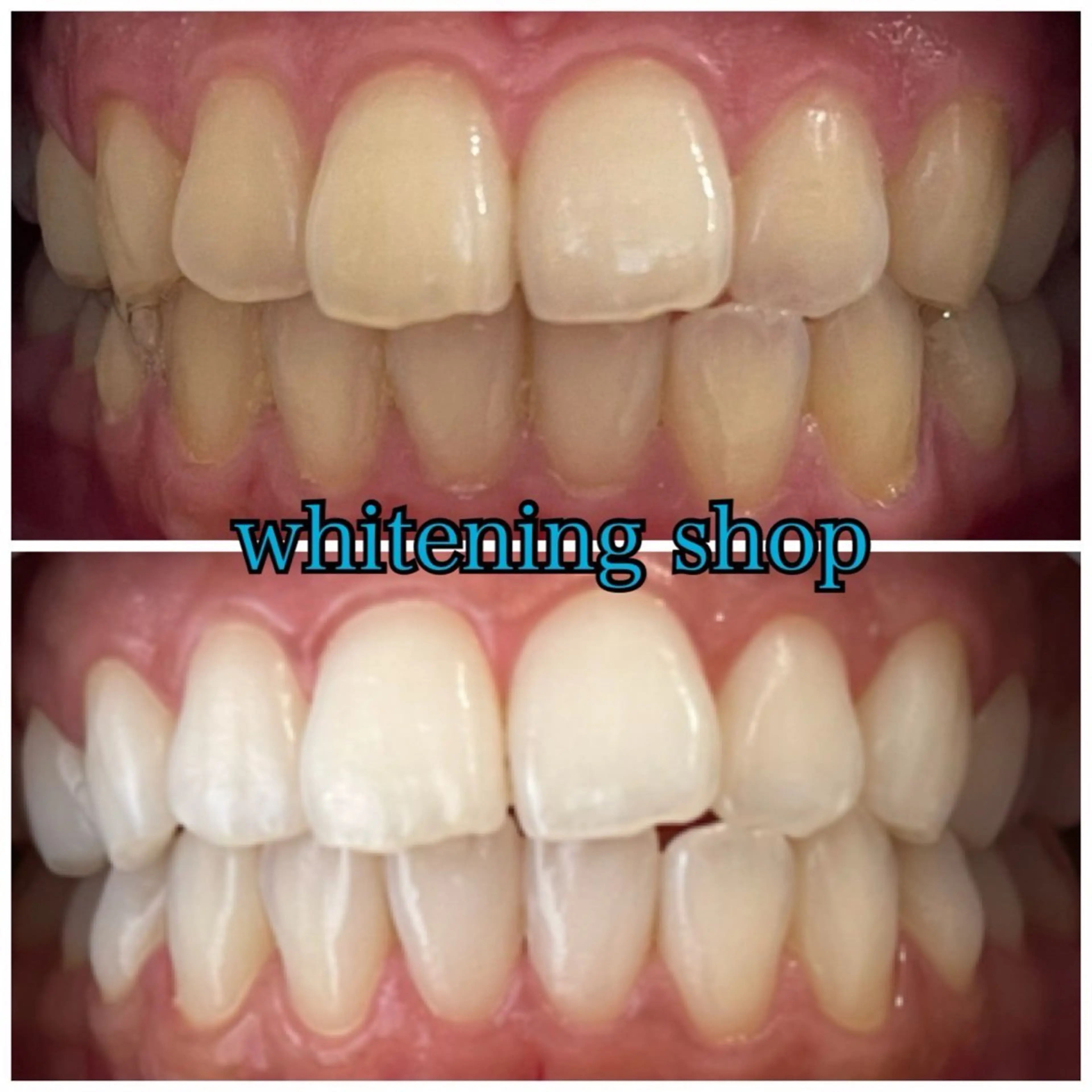 メンズ エステ リラク ホワイトニング ショップ川越店のエステ・リラクイメージ