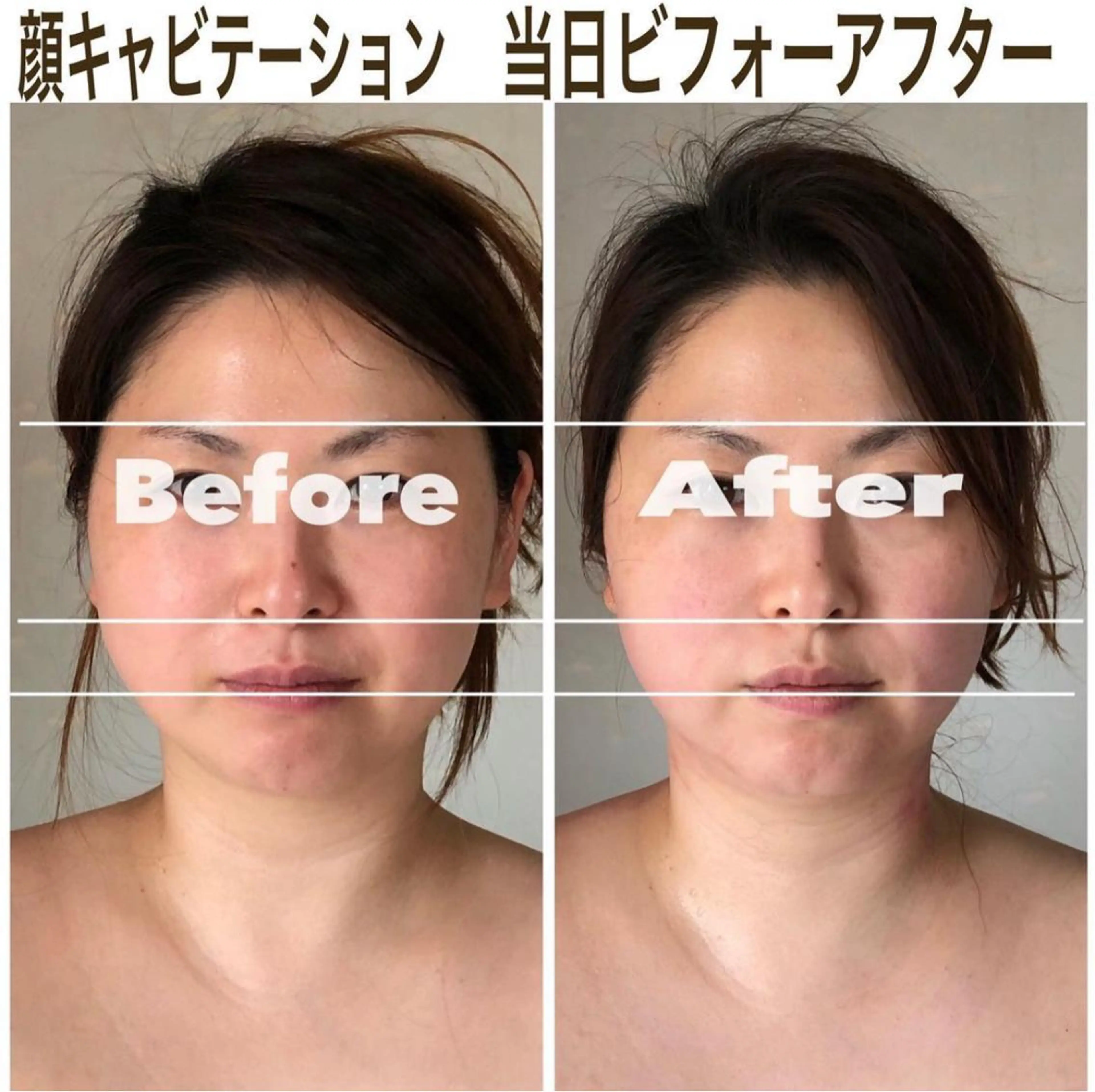 あだち整体エステ 首肩背中のゆるめぐのエステ・リラクイメージ