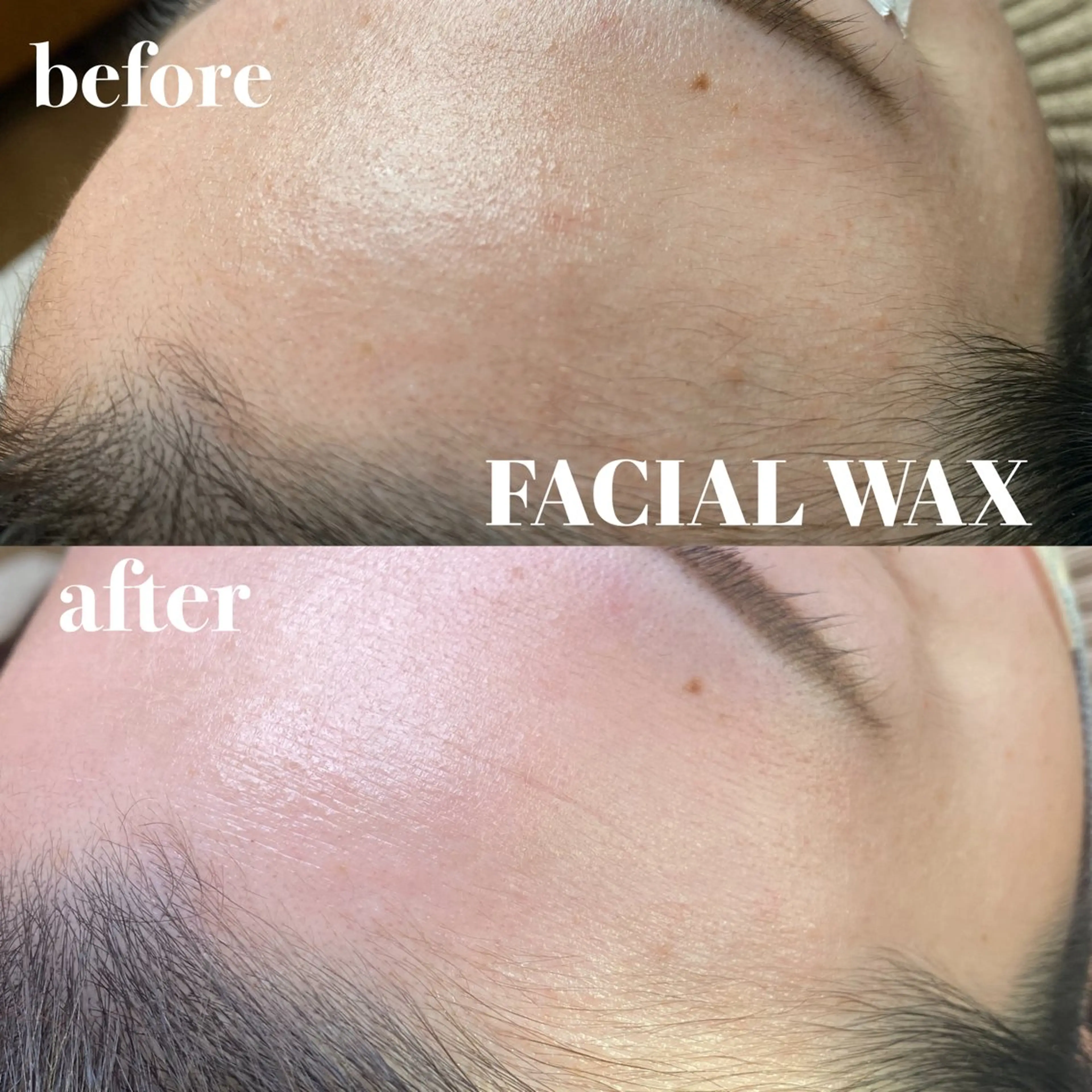 脱毛 ✿𝐥𝐚𝐟. 𝐦𝐚𝐲𝐮✿のエステ・リラクイメージ