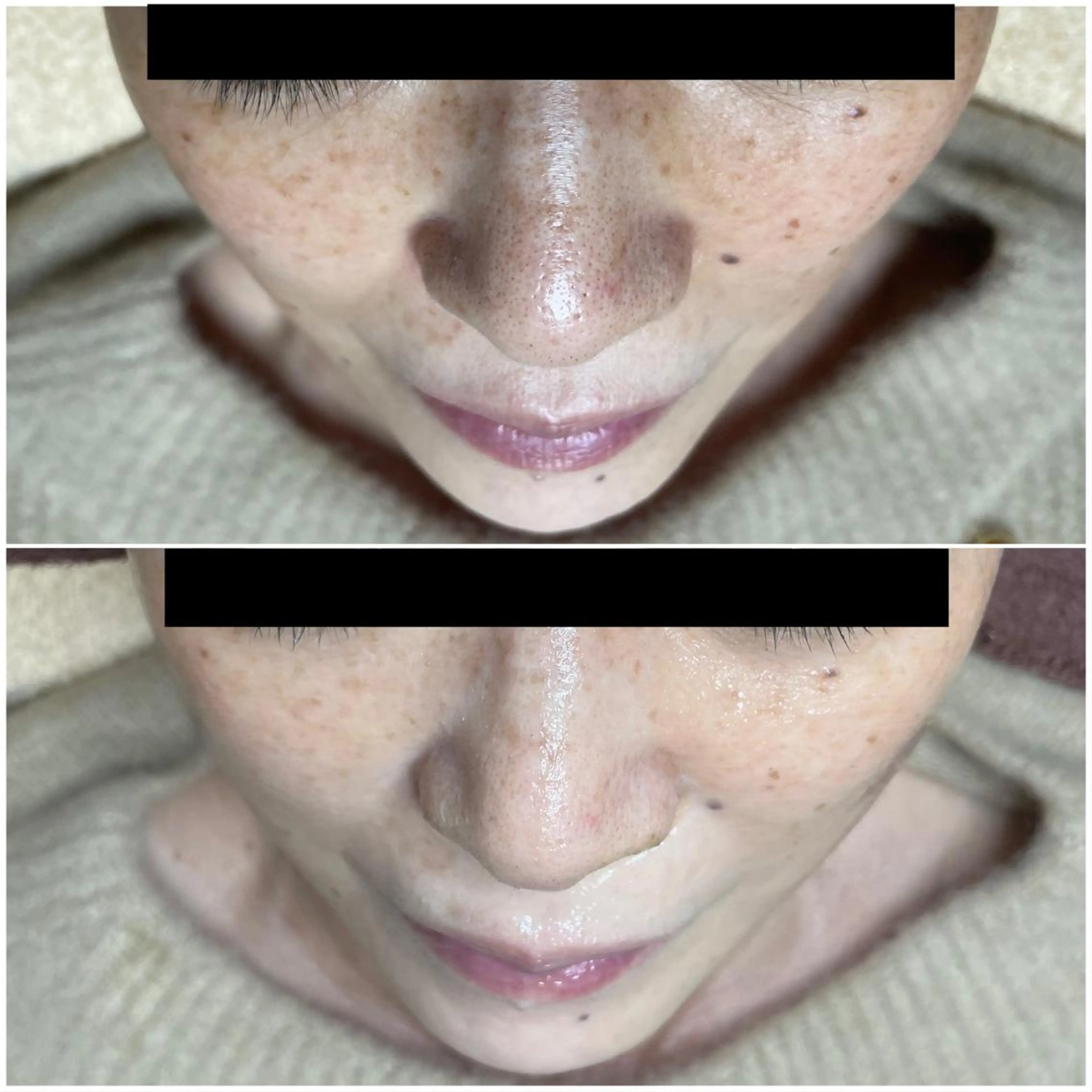 代表 MOMOのエステ・リラクイメージ