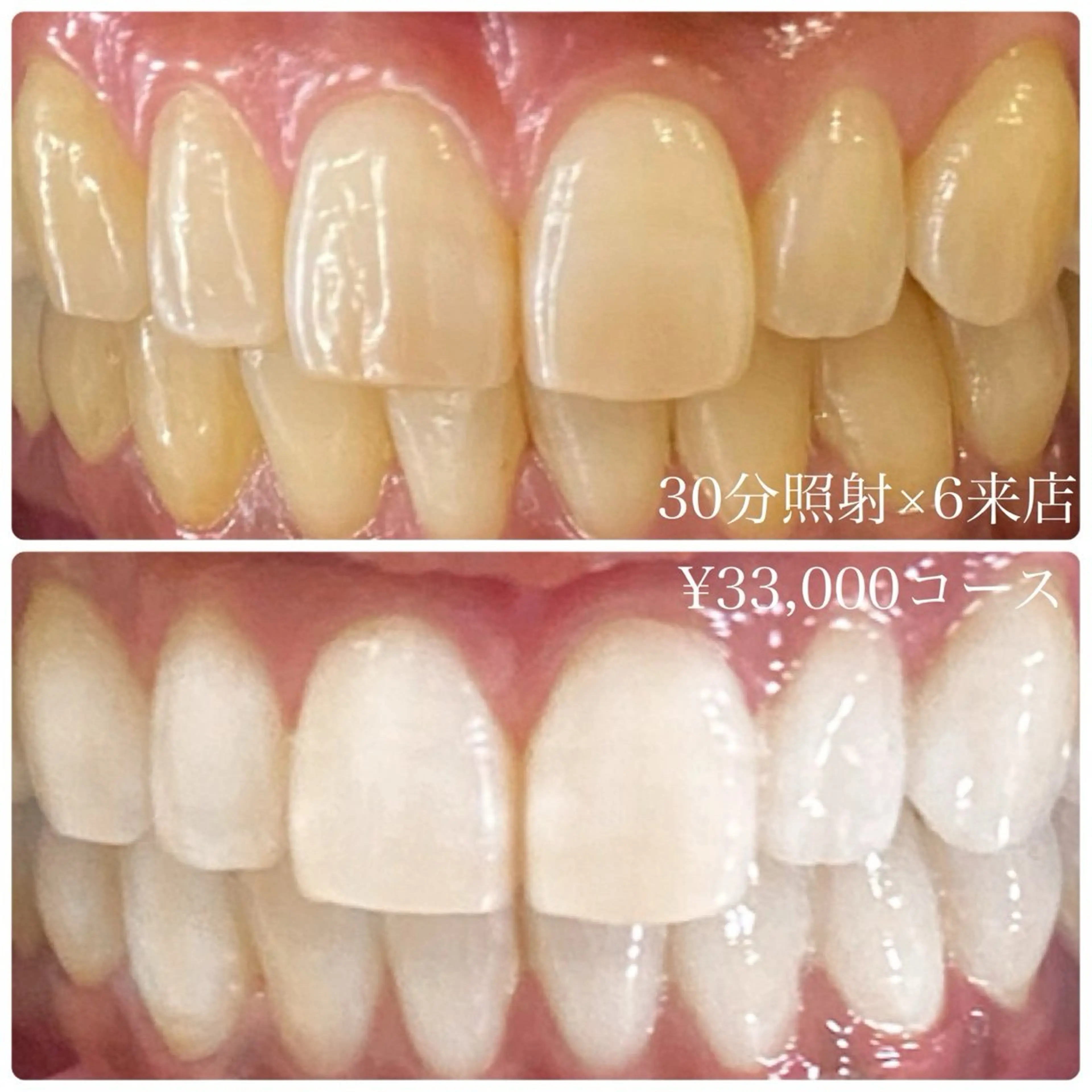 その他 ホワイトニングルーム 横浜店のその他イメージ