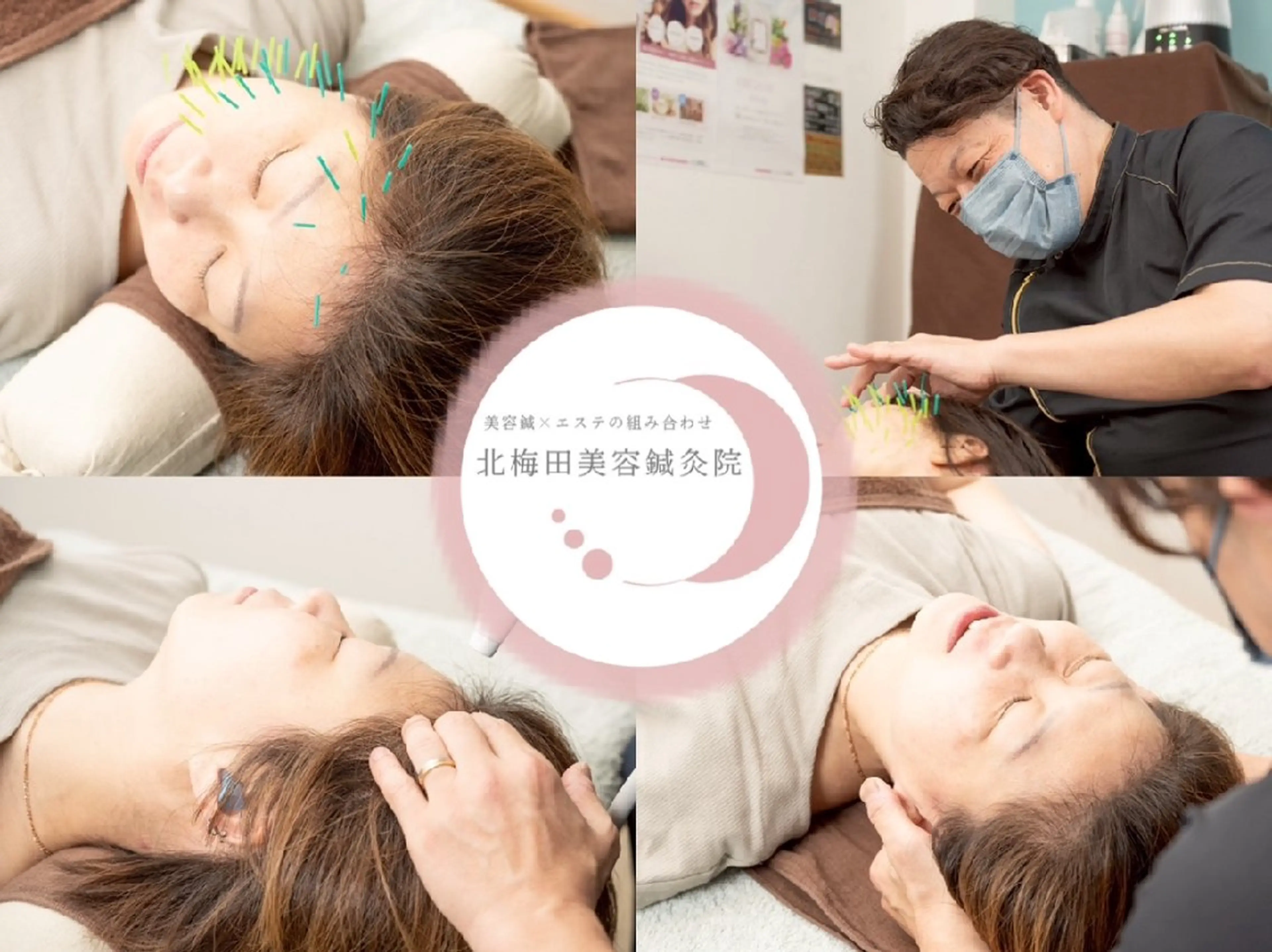 エステ リラク 北梅田美容鍼灸院所属・美容鍼マイスター 川村　淳のエステ・リラクイメージ